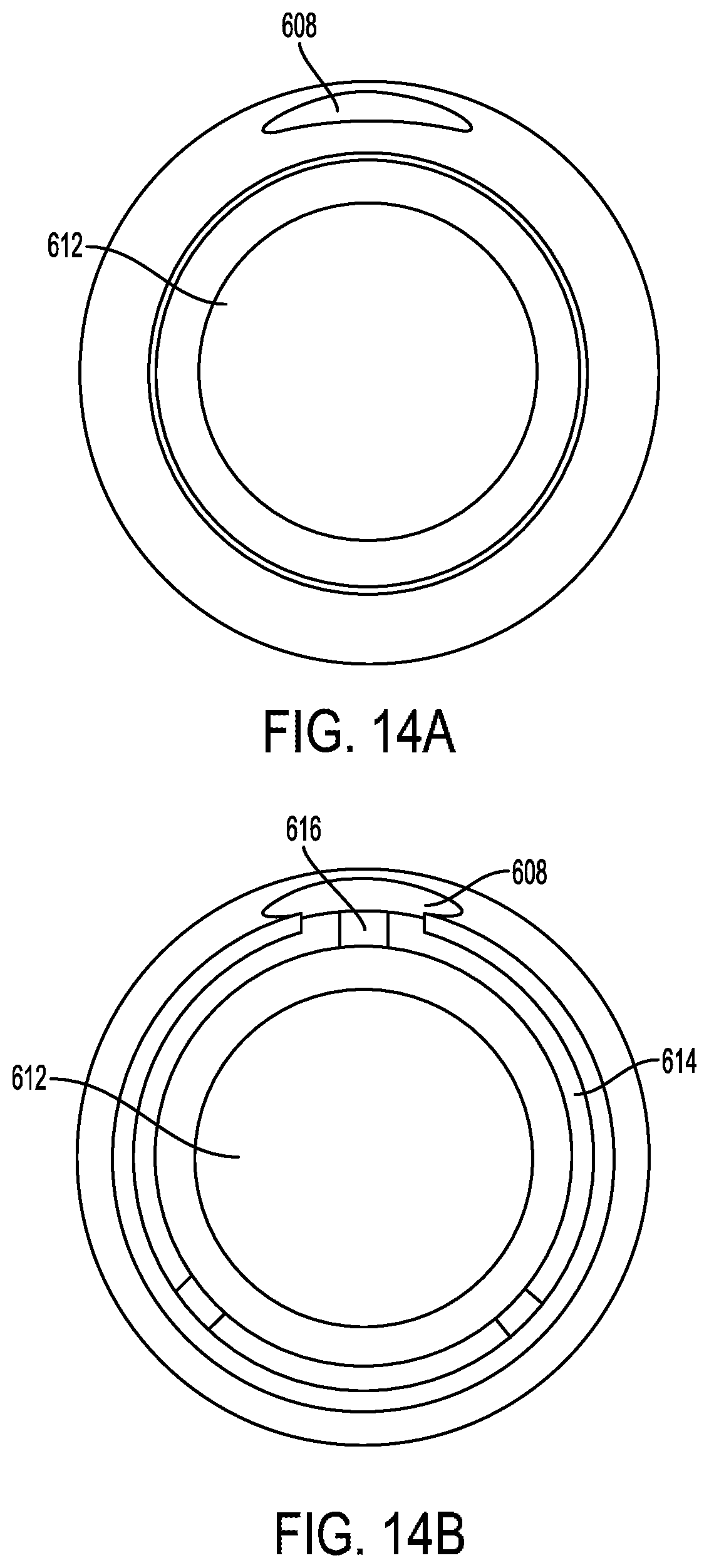 Patent US12403026 Figure 14 – Valve with docking station for gastrointestinal balloon