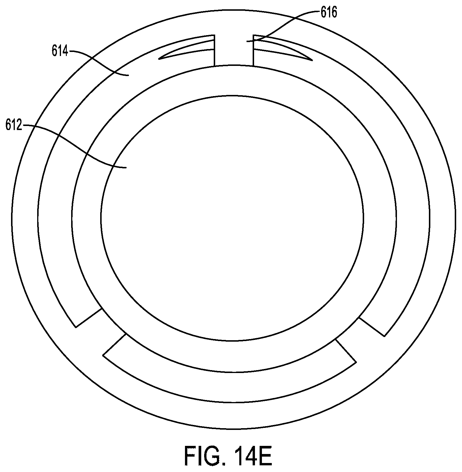 Patent US12403026 Figure 16 – Valve with docking station for gastrointestinal balloon