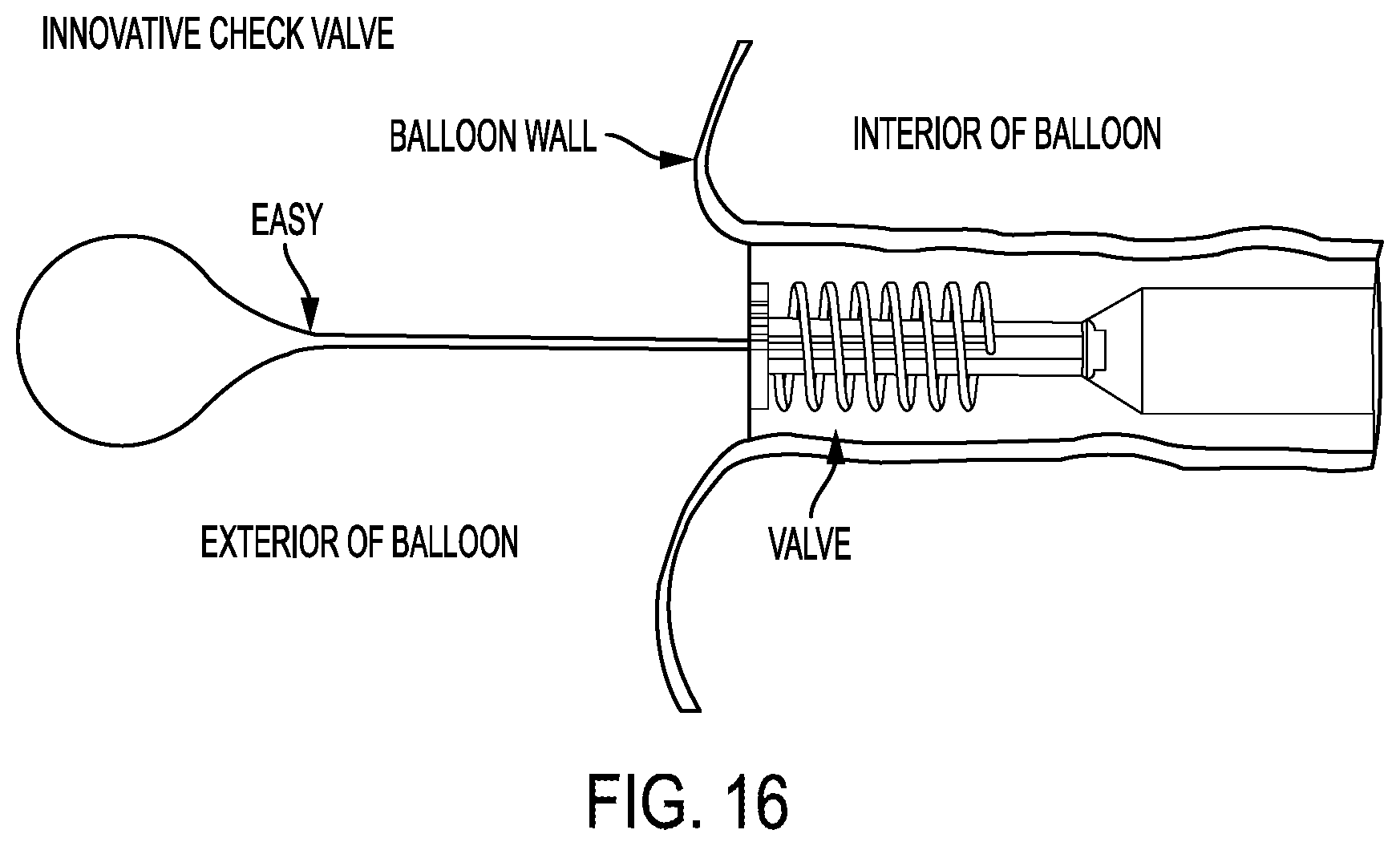 Patent US12403026 Figure 18 – Valve with docking station for gastrointestinal balloon