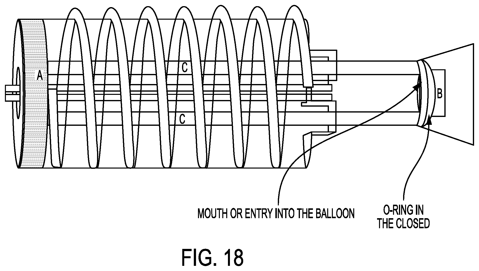 Patent US12403026 Figure 20 – Valve with docking station for gastrointestinal balloon