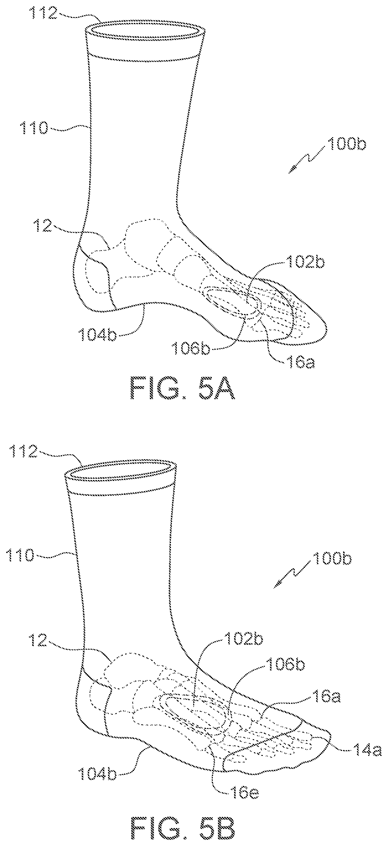Patent US12403028 Figure 2 – Sock orthotic