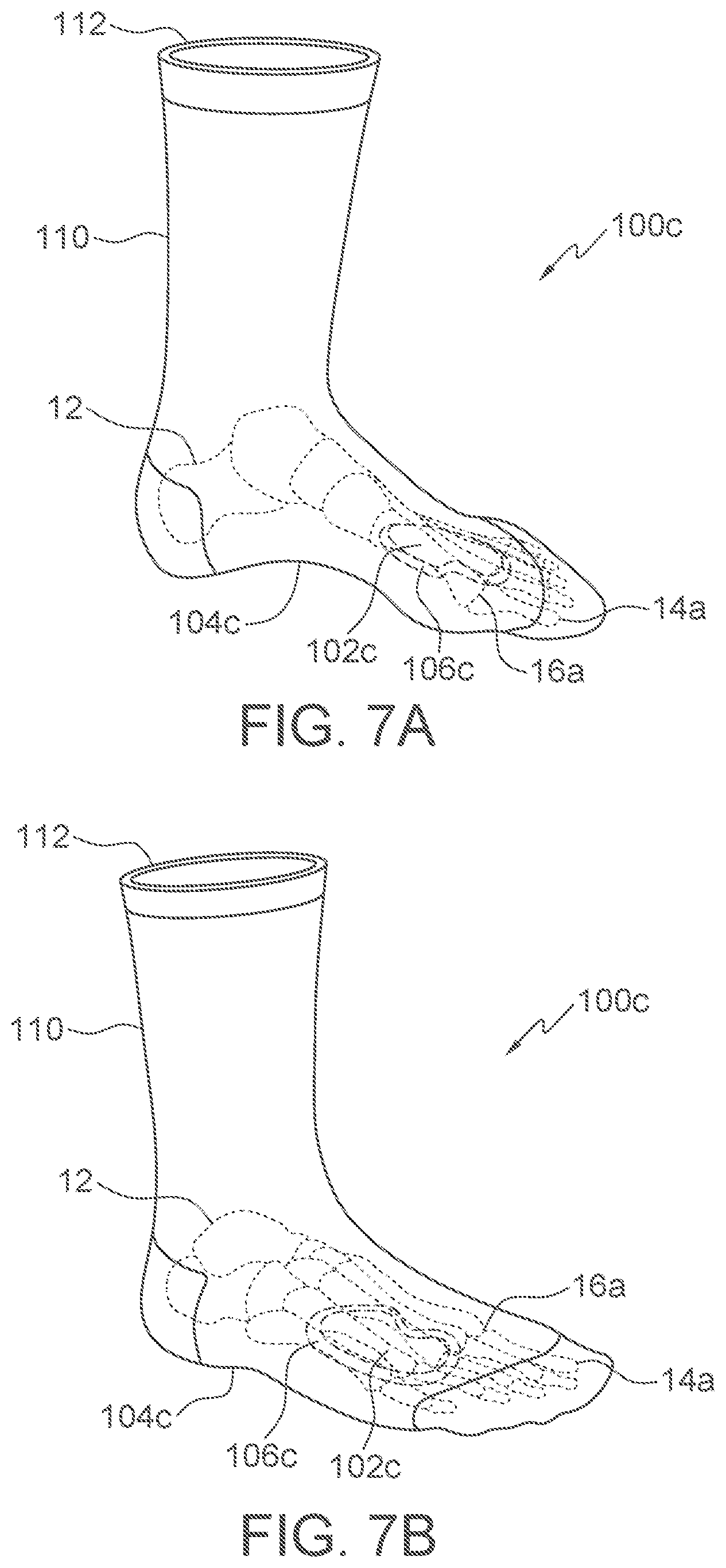 Patent US12403028 Figure 4 – Sock orthotic