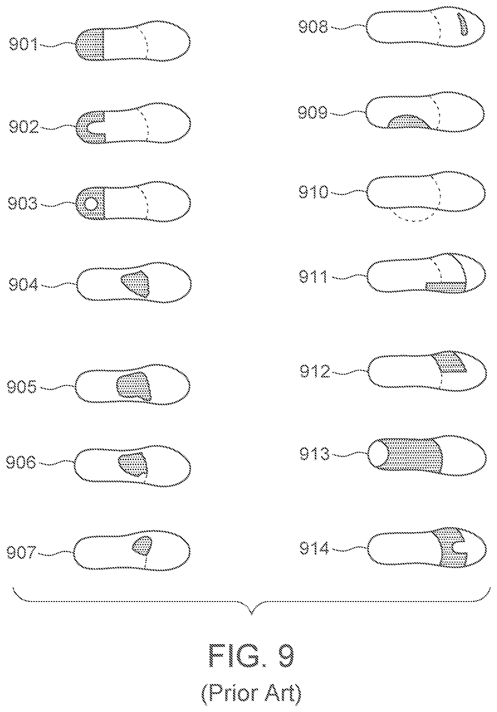 Patent US12403028 Figure 6 – Sock orthotic