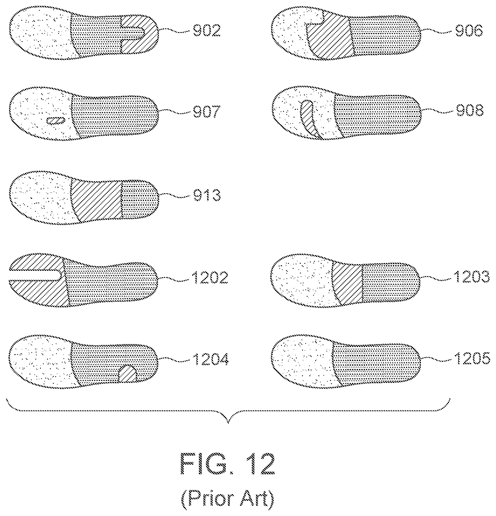 Patent US12403028 Figure 9 – Sock orthotic