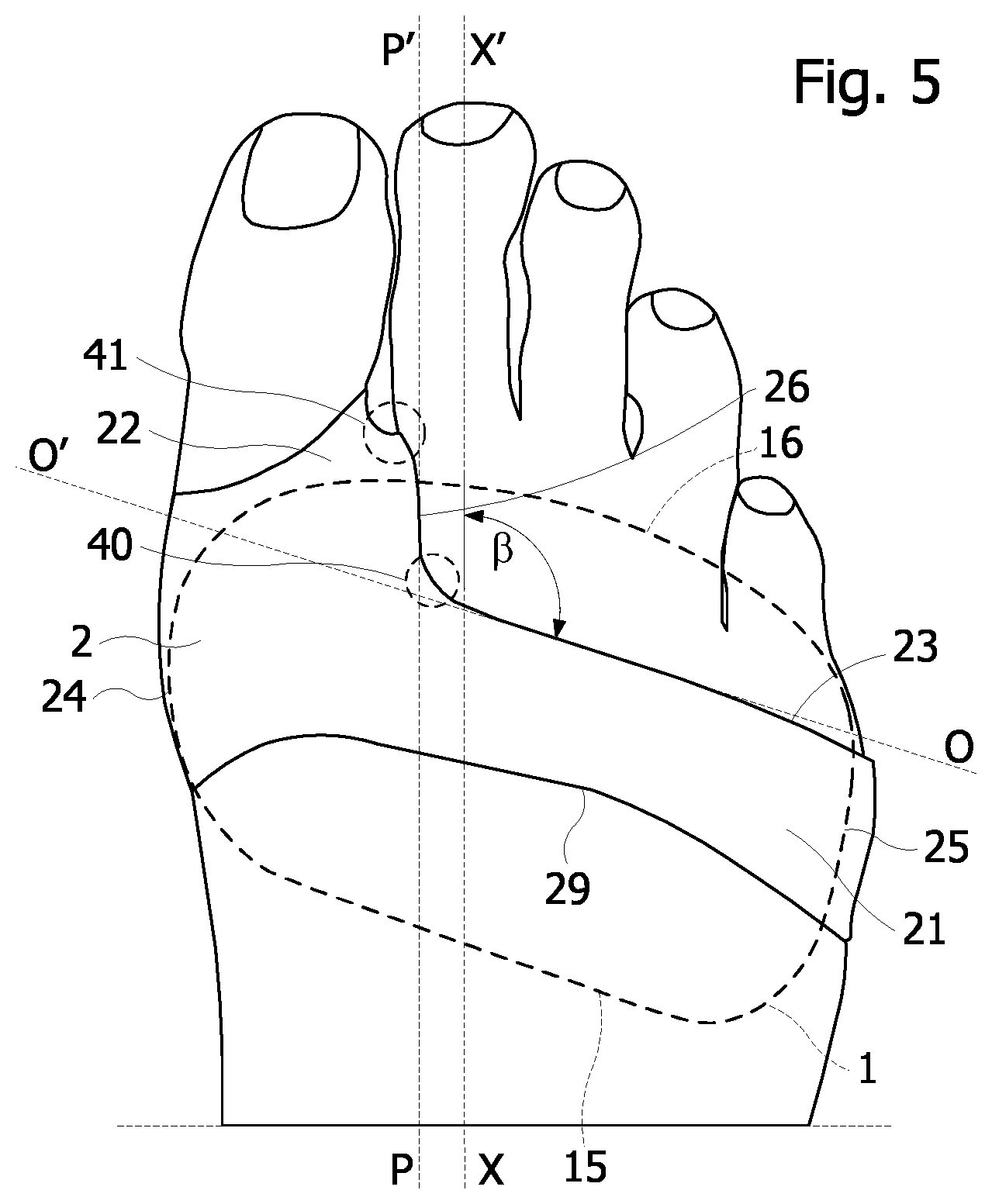 Patent US12403030 Figure 3 – Device for protecting the plantar padding