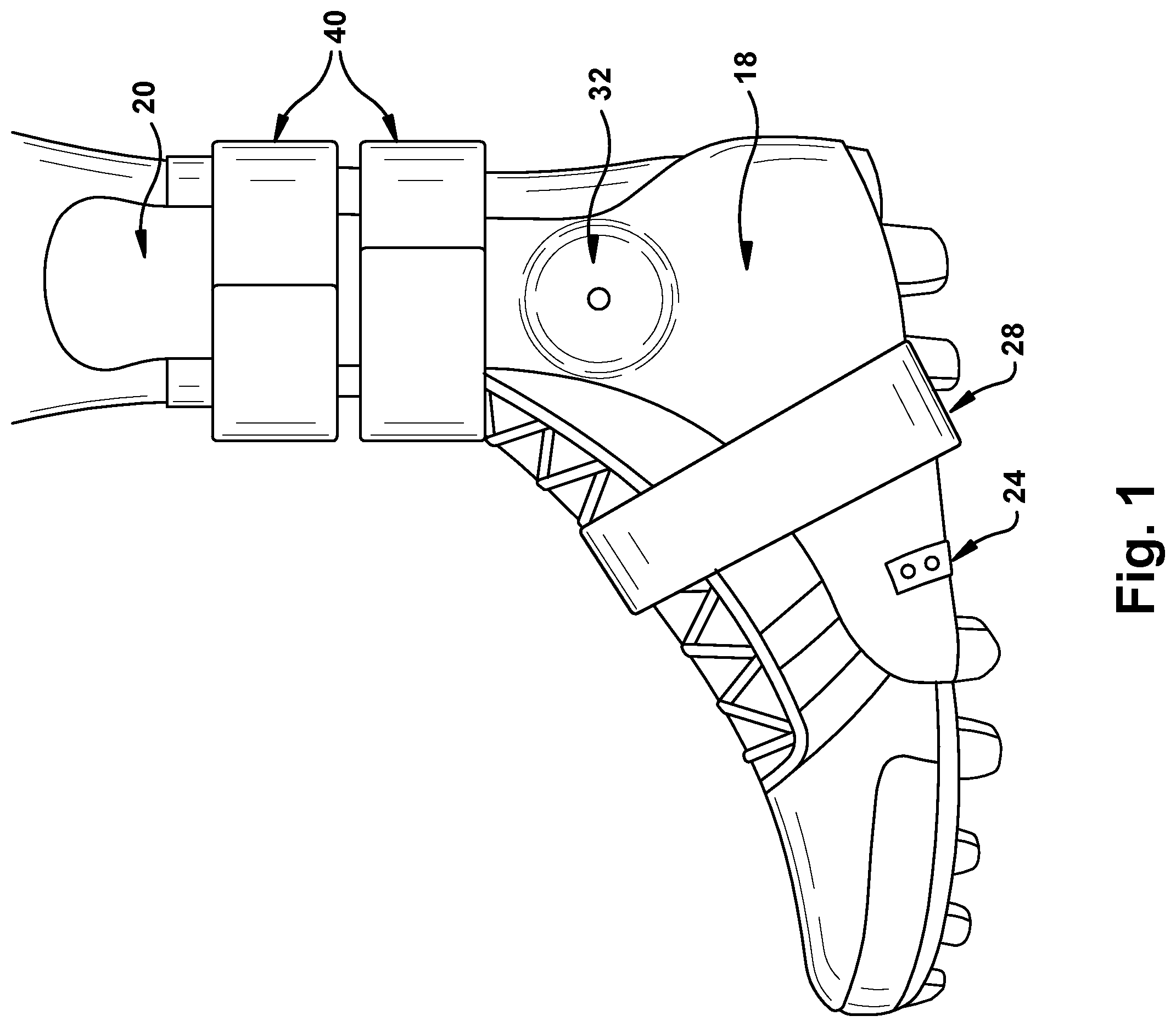 Patent US12403031 Figure 1 – External ankle brace