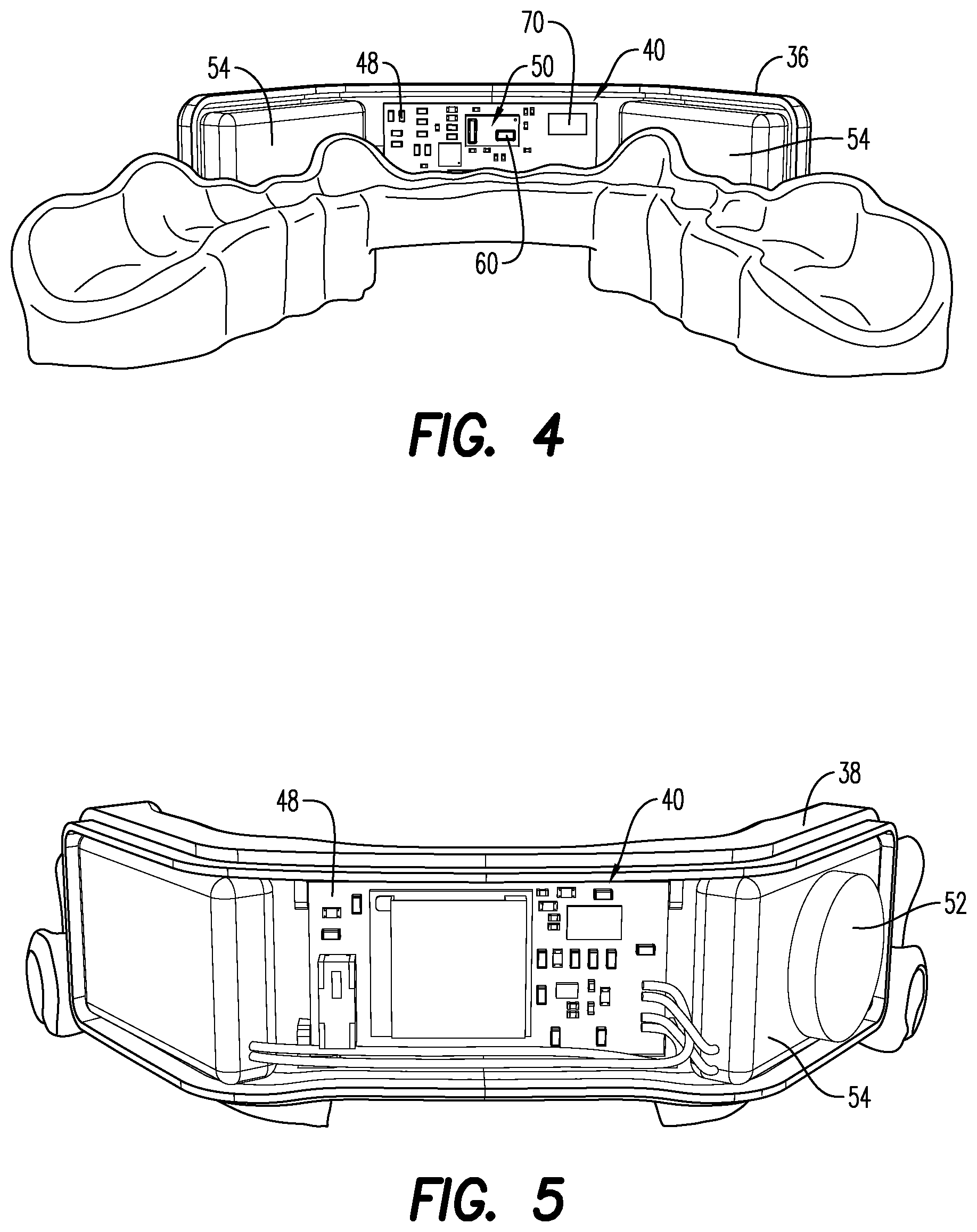 Patent US12403033 Figure 3 – Oral appliance for the treatment of sleep apnea