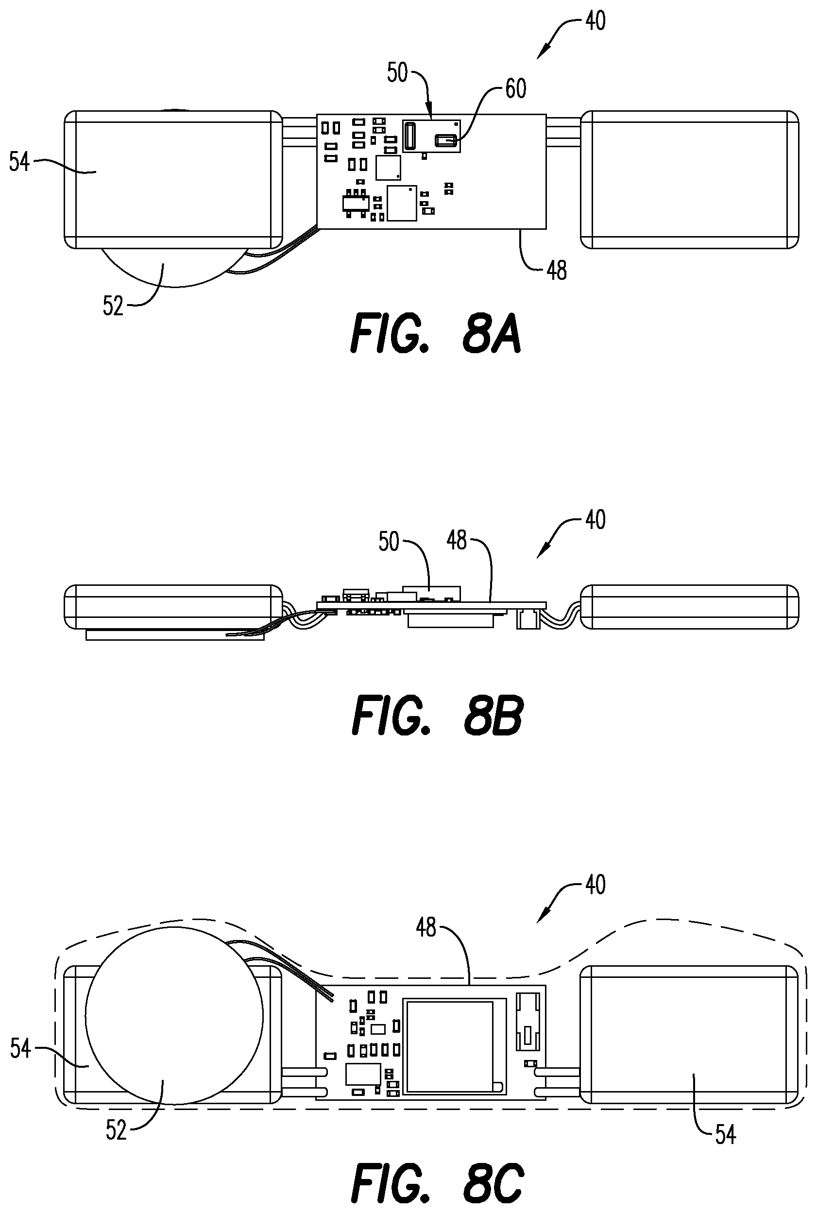 Patent US12403033 Figure 5 – Oral appliance for the treatment of sleep apnea
