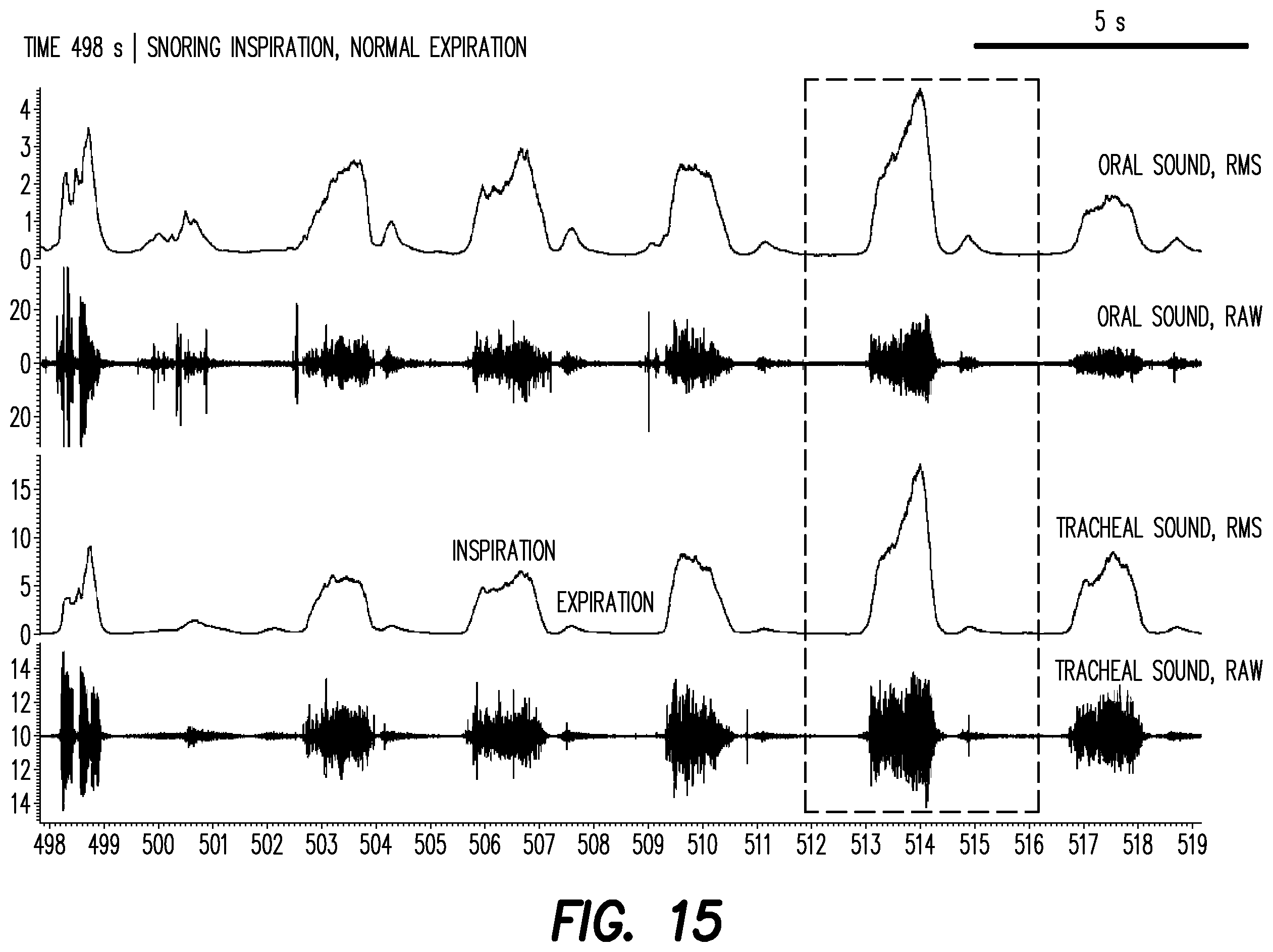 Patent US12403033 Figure 10 – Oral appliance for the treatment of sleep apnea
