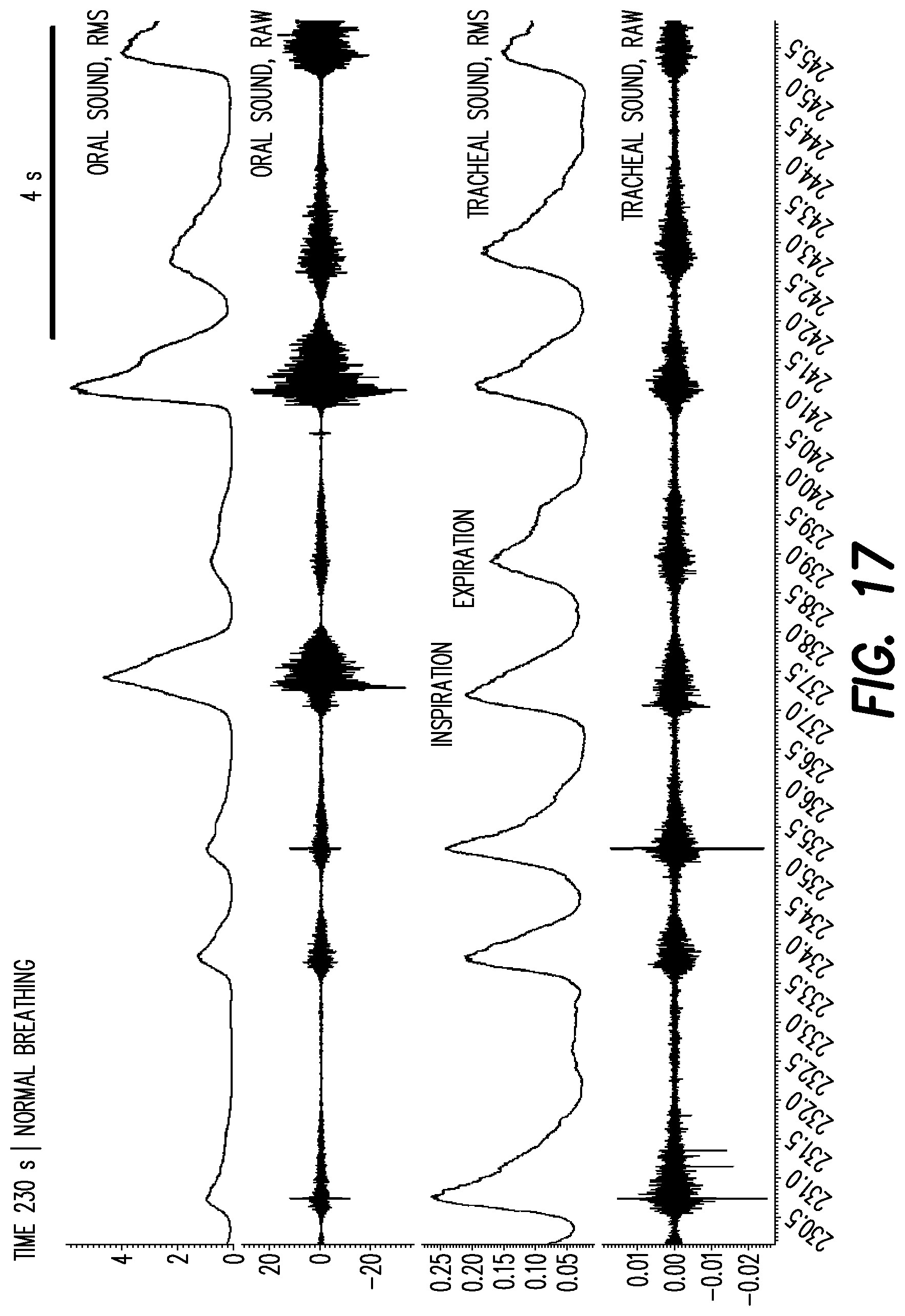 Patent US12403033 Figure 12 – Oral appliance for the treatment of sleep apnea