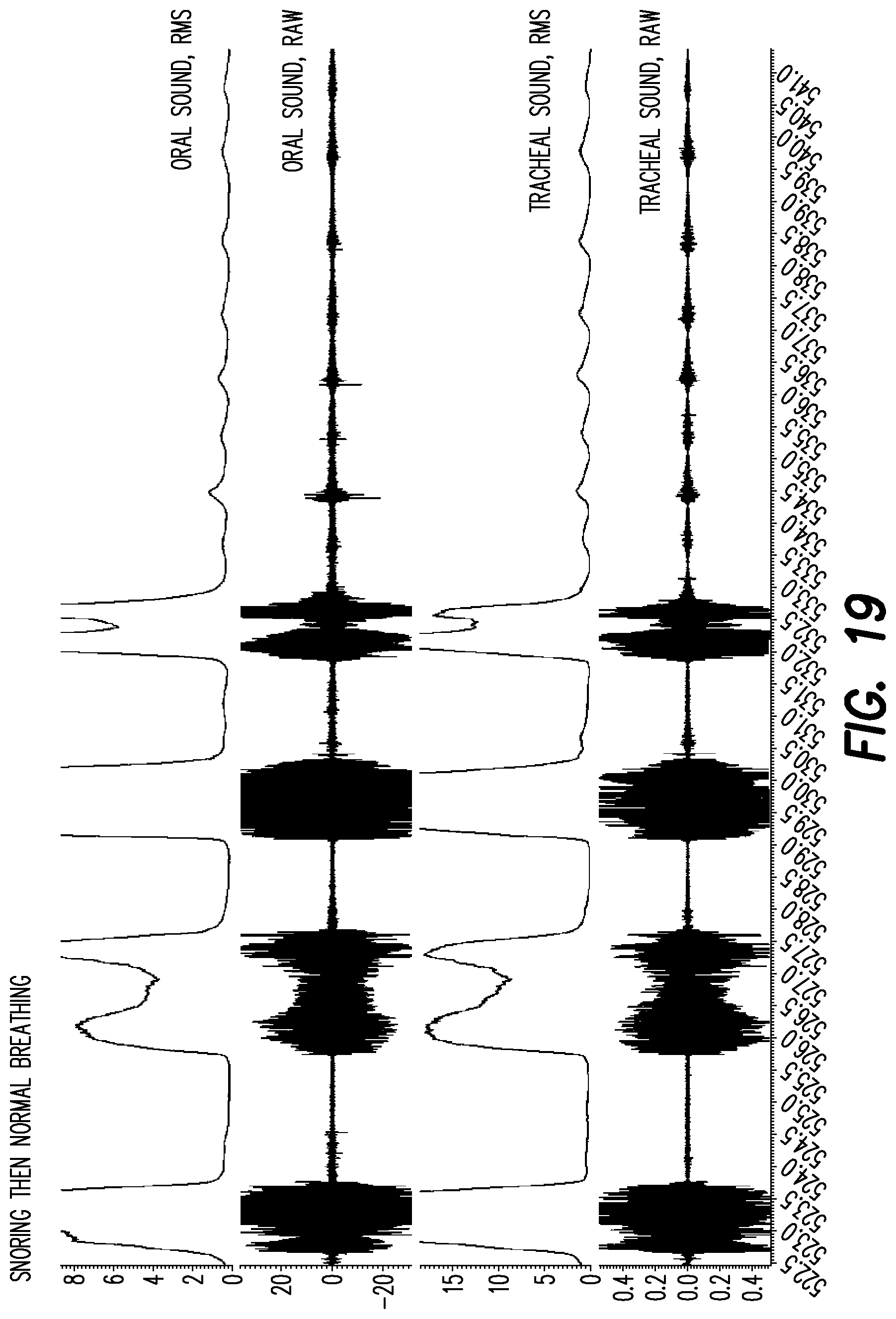 Patent US12403033 Figure 14 – Oral appliance for the treatment of sleep apnea