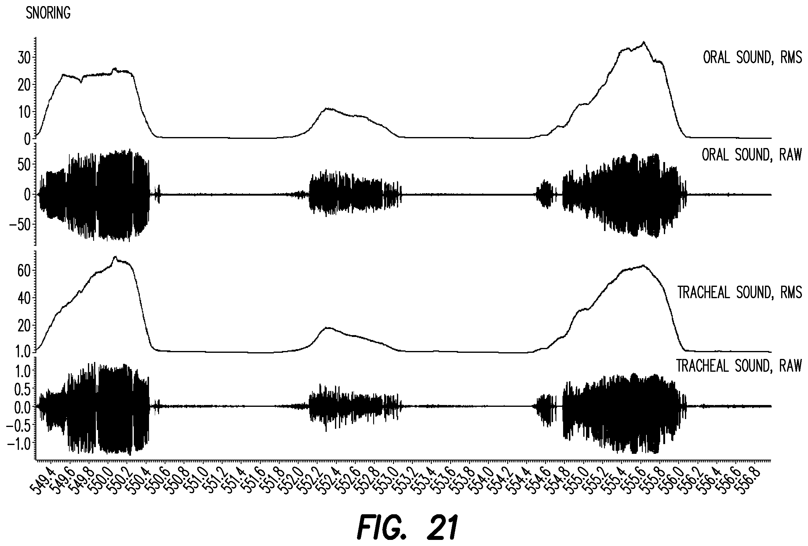 Patent US12403033 Figure 16 – Oral appliance for the treatment of sleep apnea