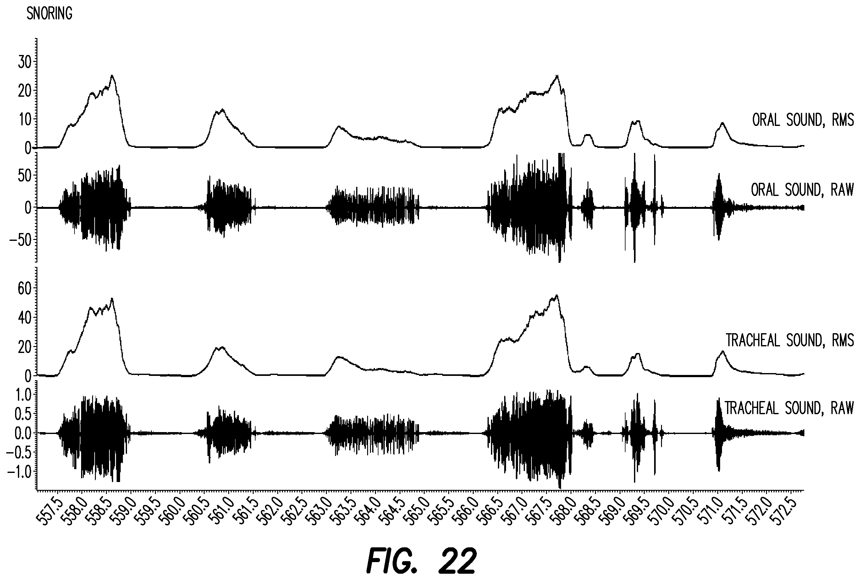 Patent US12403033 Figure 17 – Oral appliance for the treatment of sleep apnea
