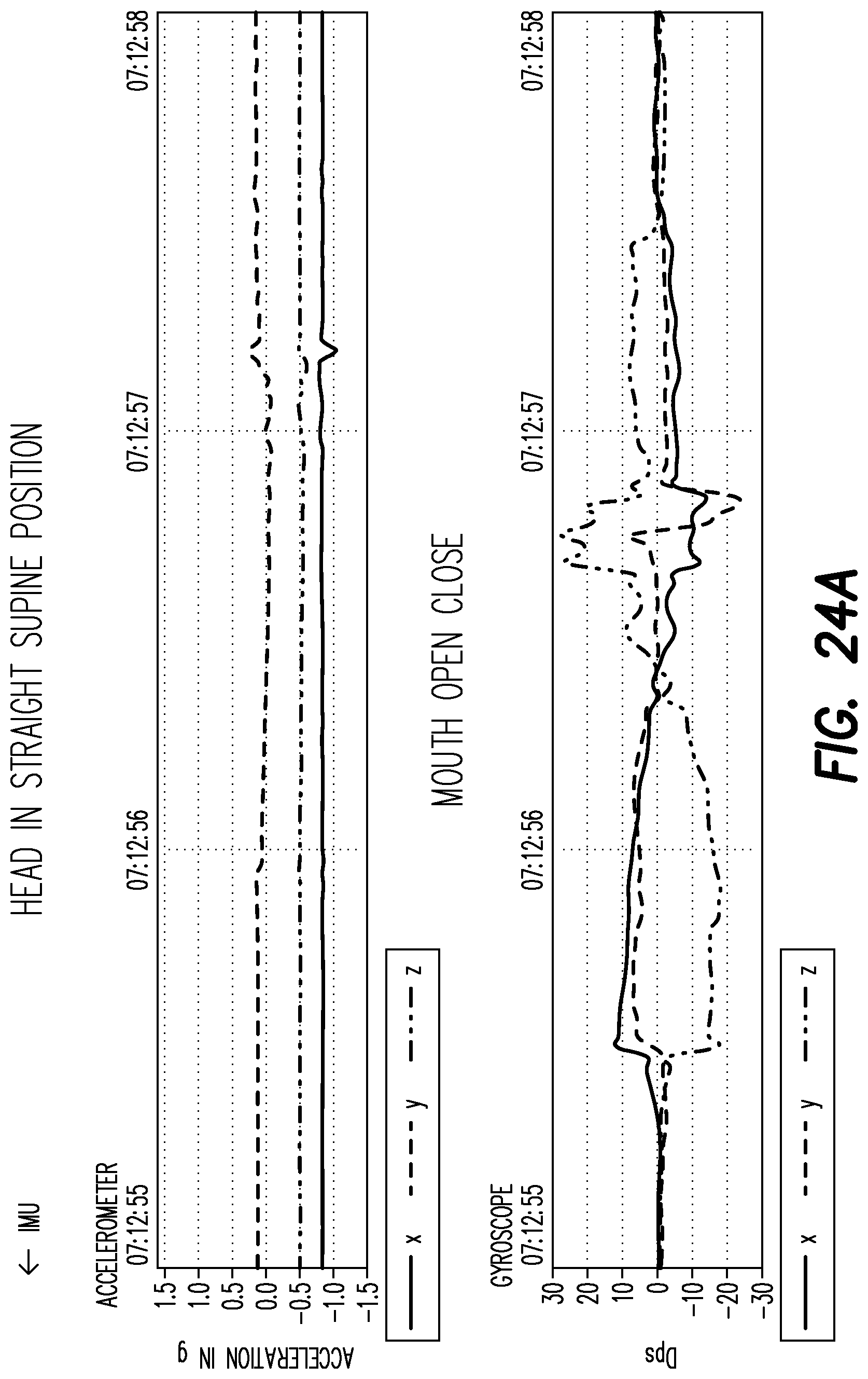 Patent US12403033 Figure 19 – Oral appliance for the treatment of sleep apnea