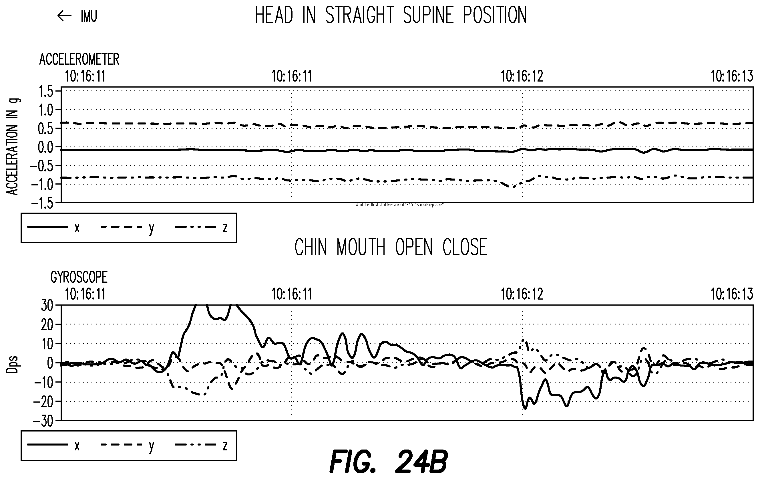 Patent US12403033 Figure 20 – Oral appliance for the treatment of sleep apnea