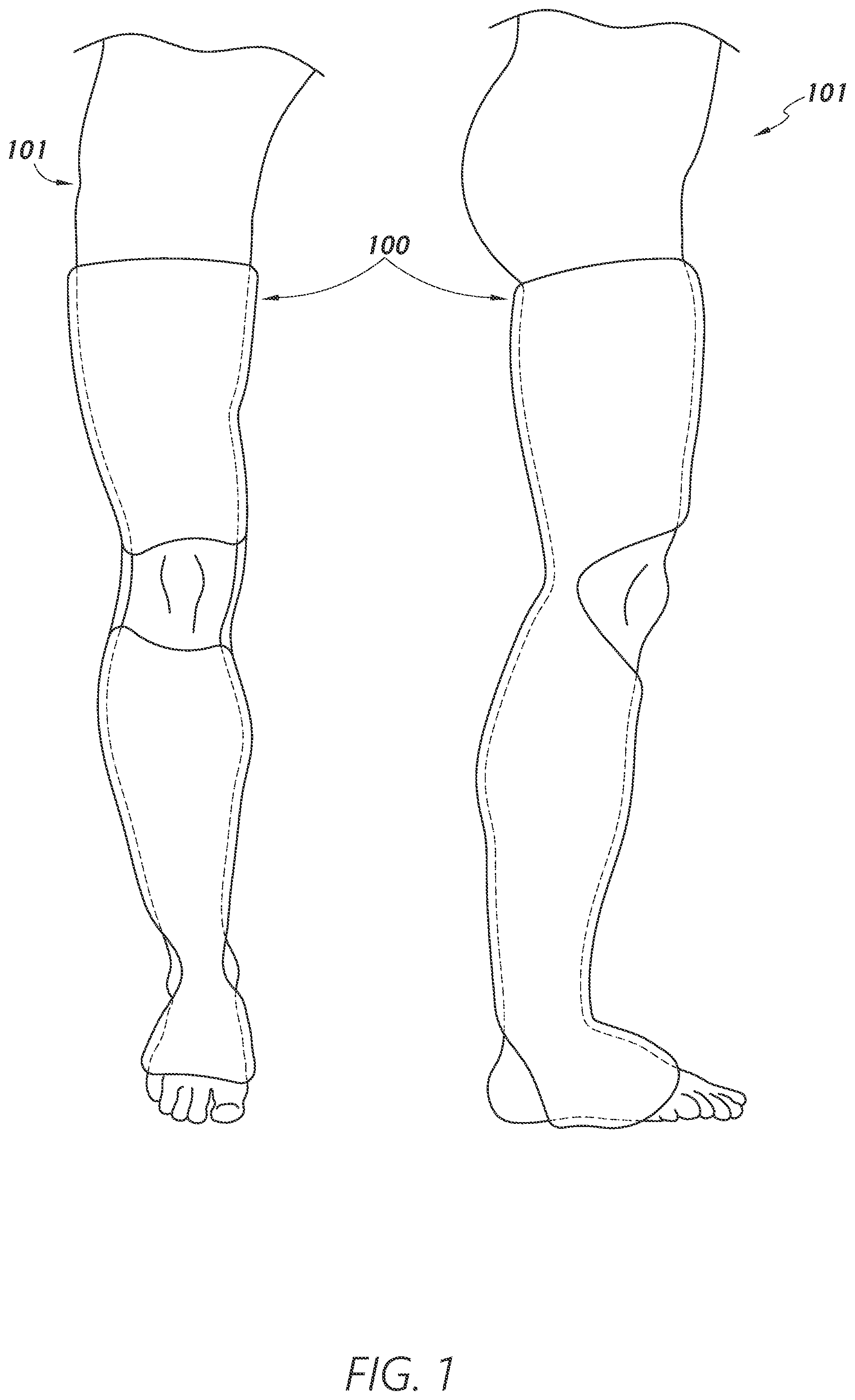 Patent US12403034 Figure 1 – Sleeve-based body temperature regulation