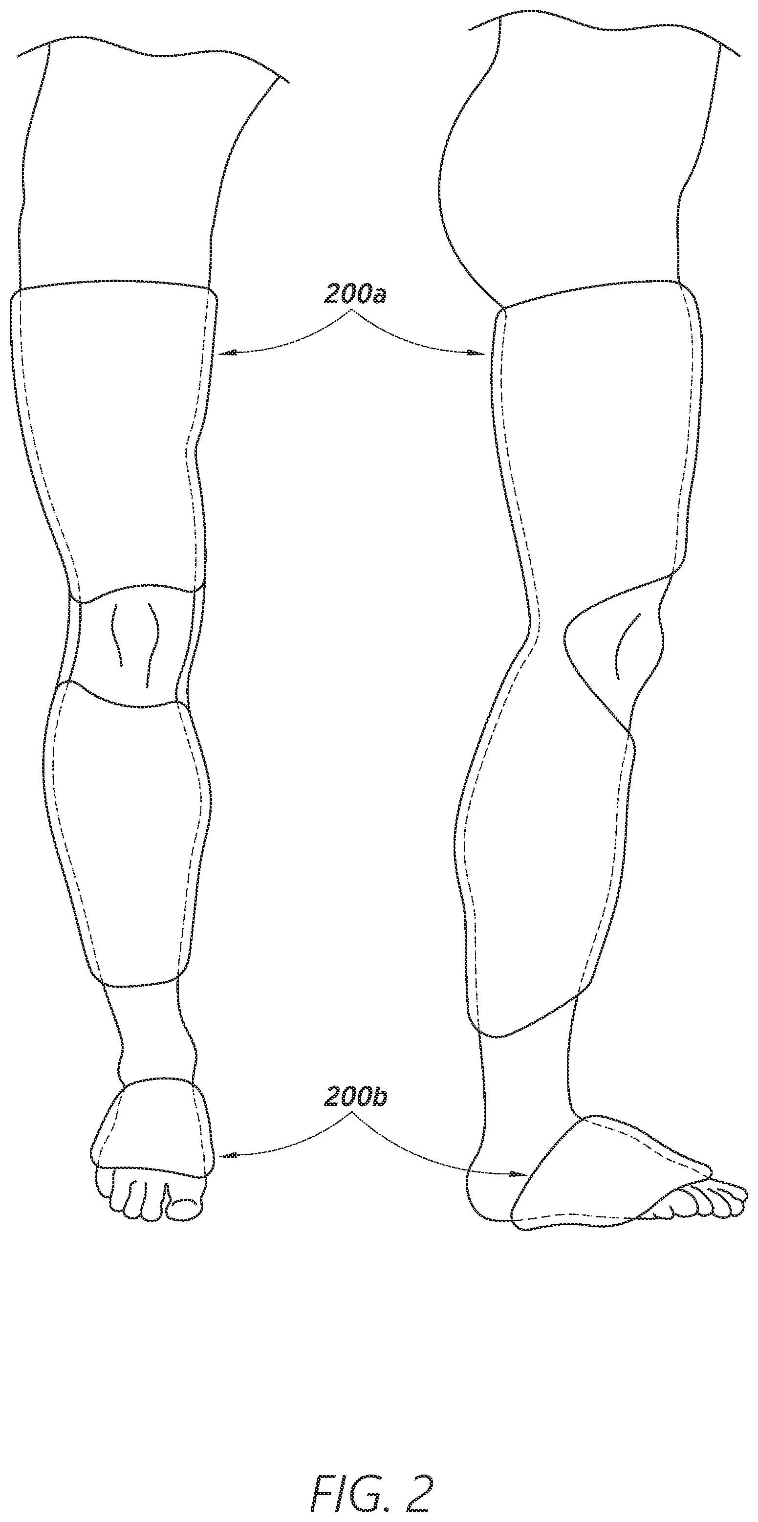 Patent US12403034 Figure 2 – Sleeve-based body temperature regulation