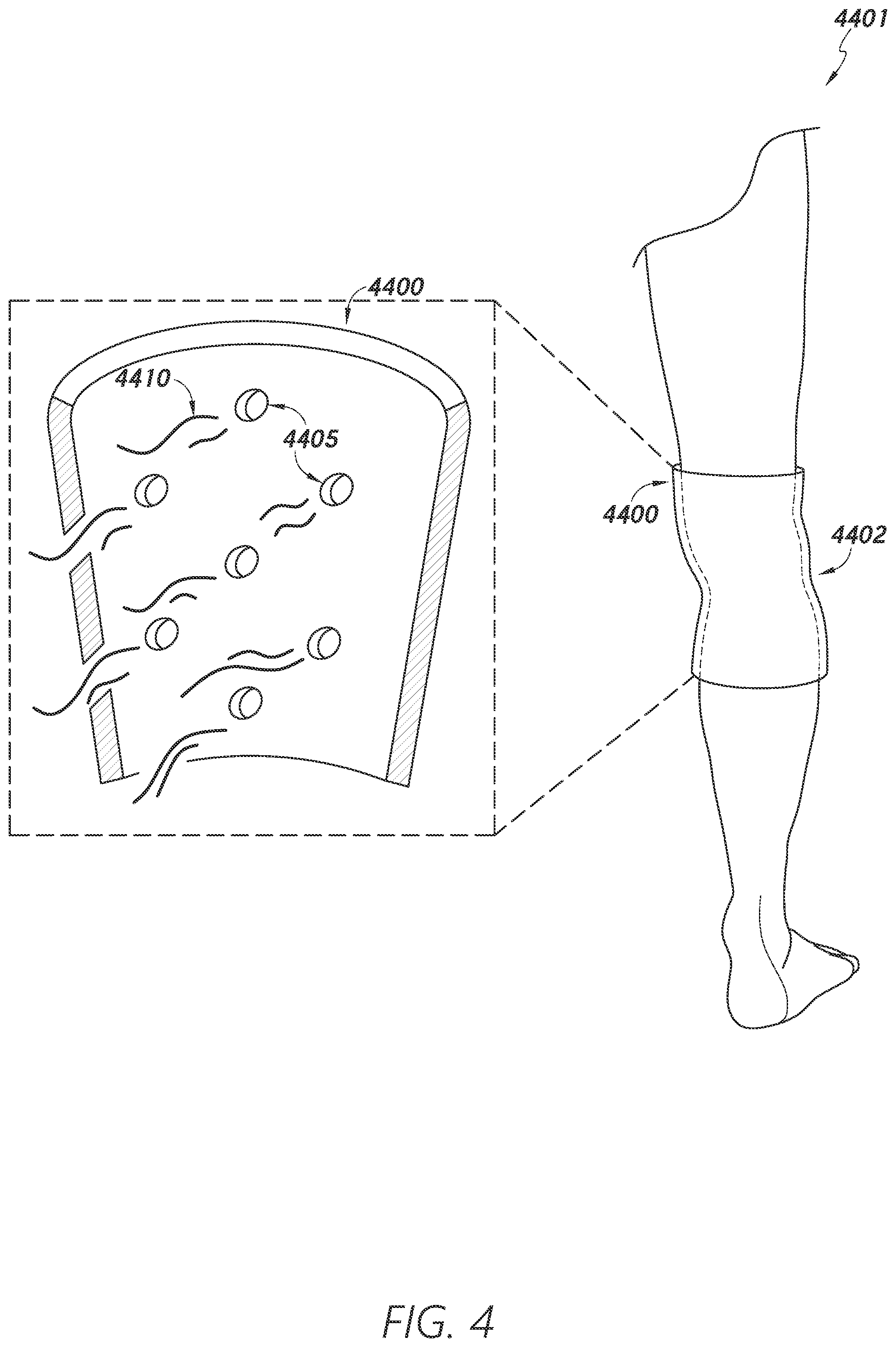 Patent US12403034 Figure 4 – Sleeve-based body temperature regulation