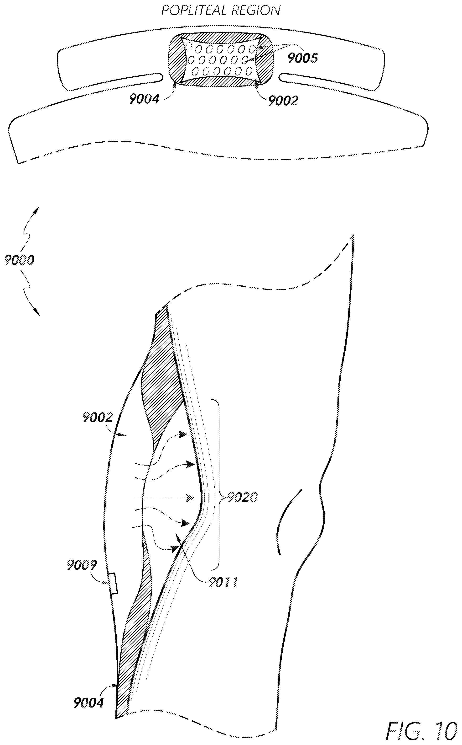 Patent US12403034 Figure 11 – Sleeve-based body temperature regulation