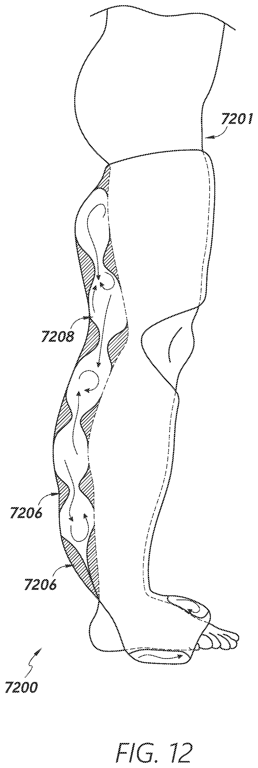 Patent US12403034 Figure 13 – Sleeve-based body temperature regulation