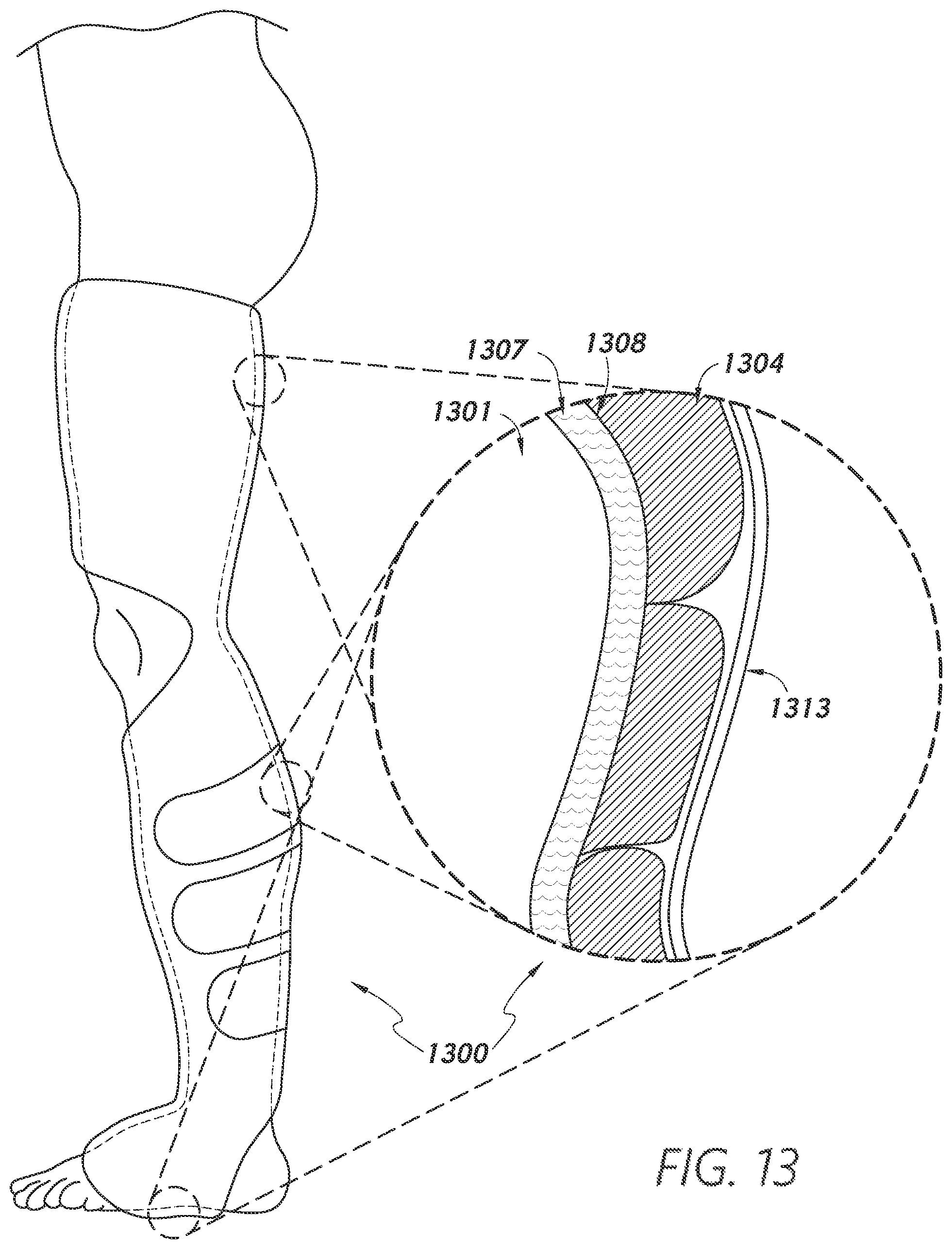 Patent US12403034 Figure 14 – Sleeve-based body temperature regulation