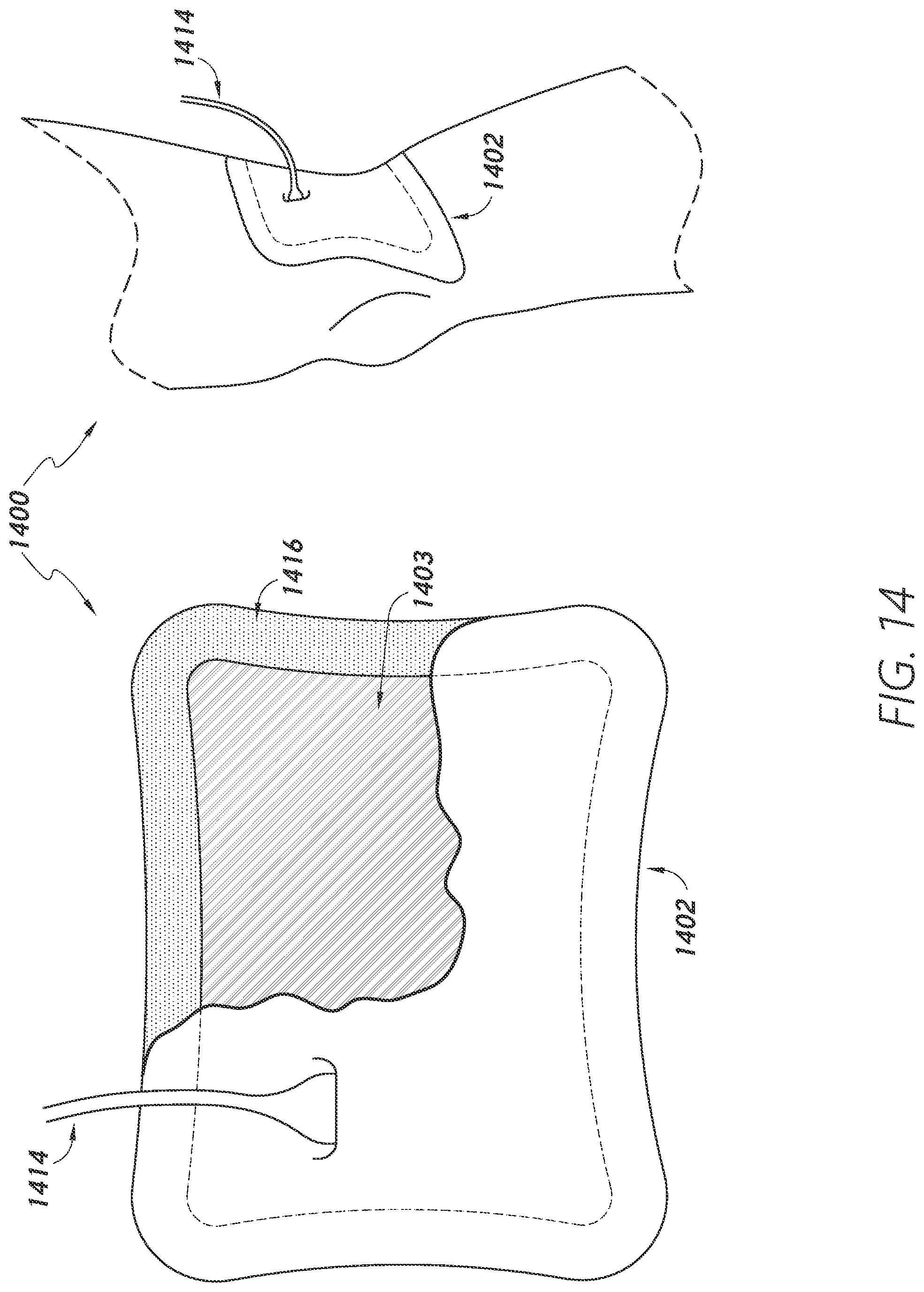 Patent US12403034 Figure 15 – Sleeve-based body temperature regulation