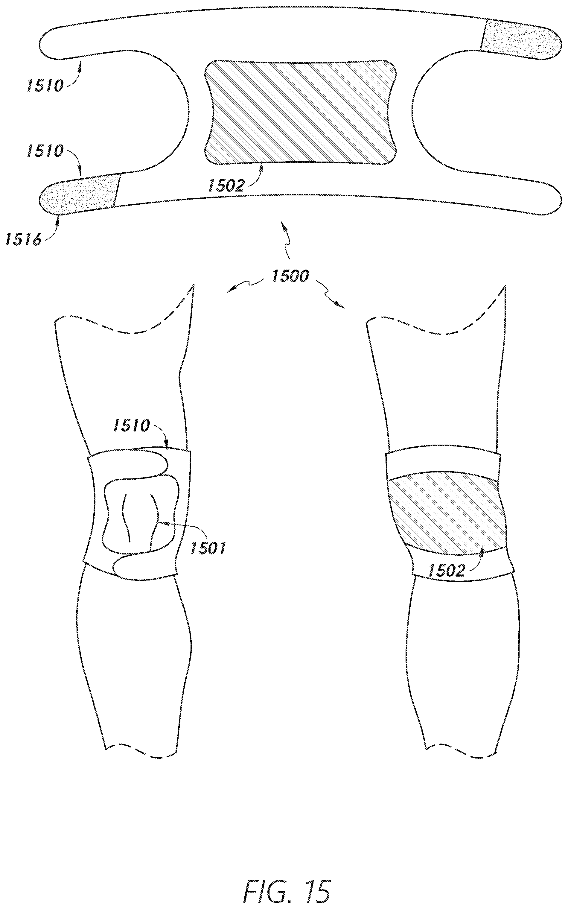 Patent US12403034 Figure 16 – Sleeve-based body temperature regulation