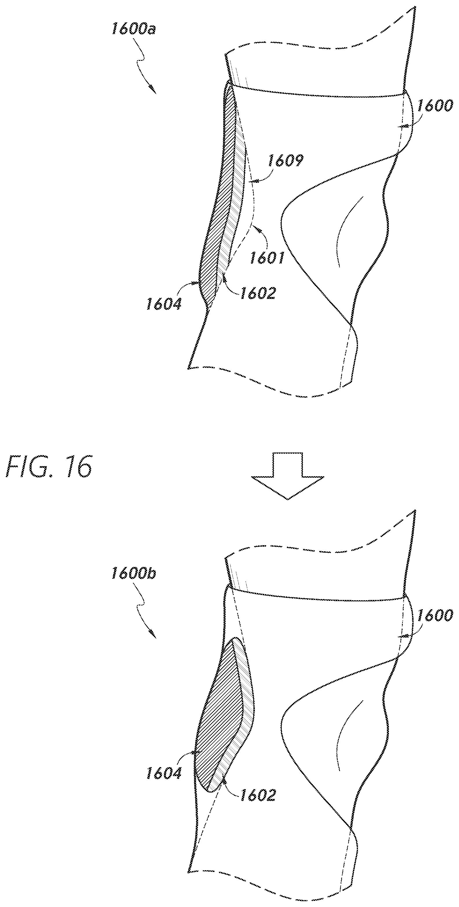 Patent US12403034 Figure 17 – Sleeve-based body temperature regulation