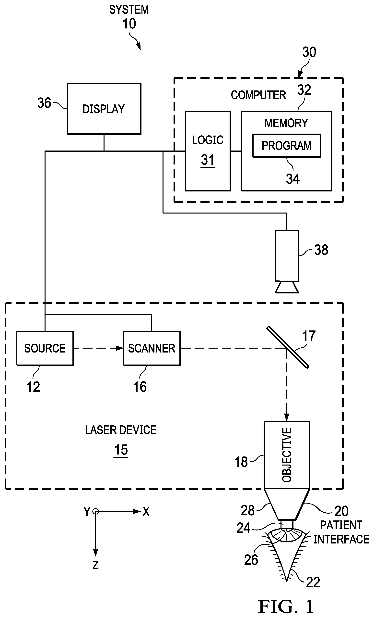 Patent US12403038 Figure 1 – Systems and methods for creating a lenticule for presbyopia