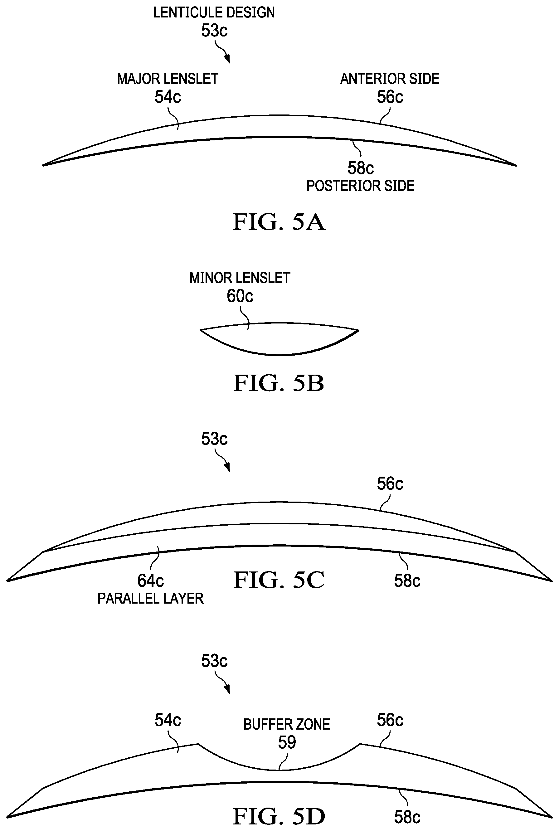 Patent US12403038 Figure 5 – Systems and methods for creating a lenticule for presbyopia