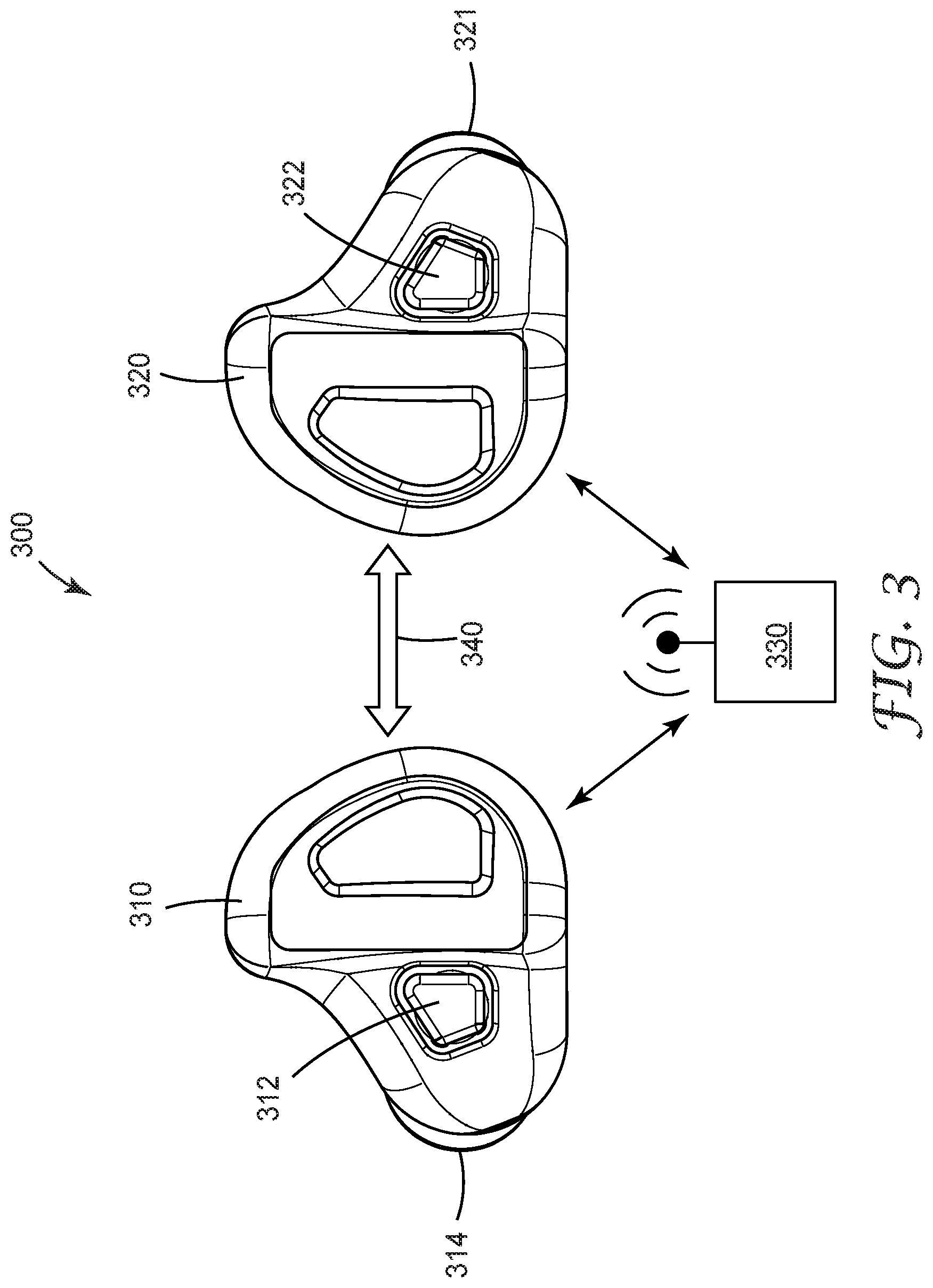 Patent US12403041 Figure 3 – Coordinated dichotic sound compression