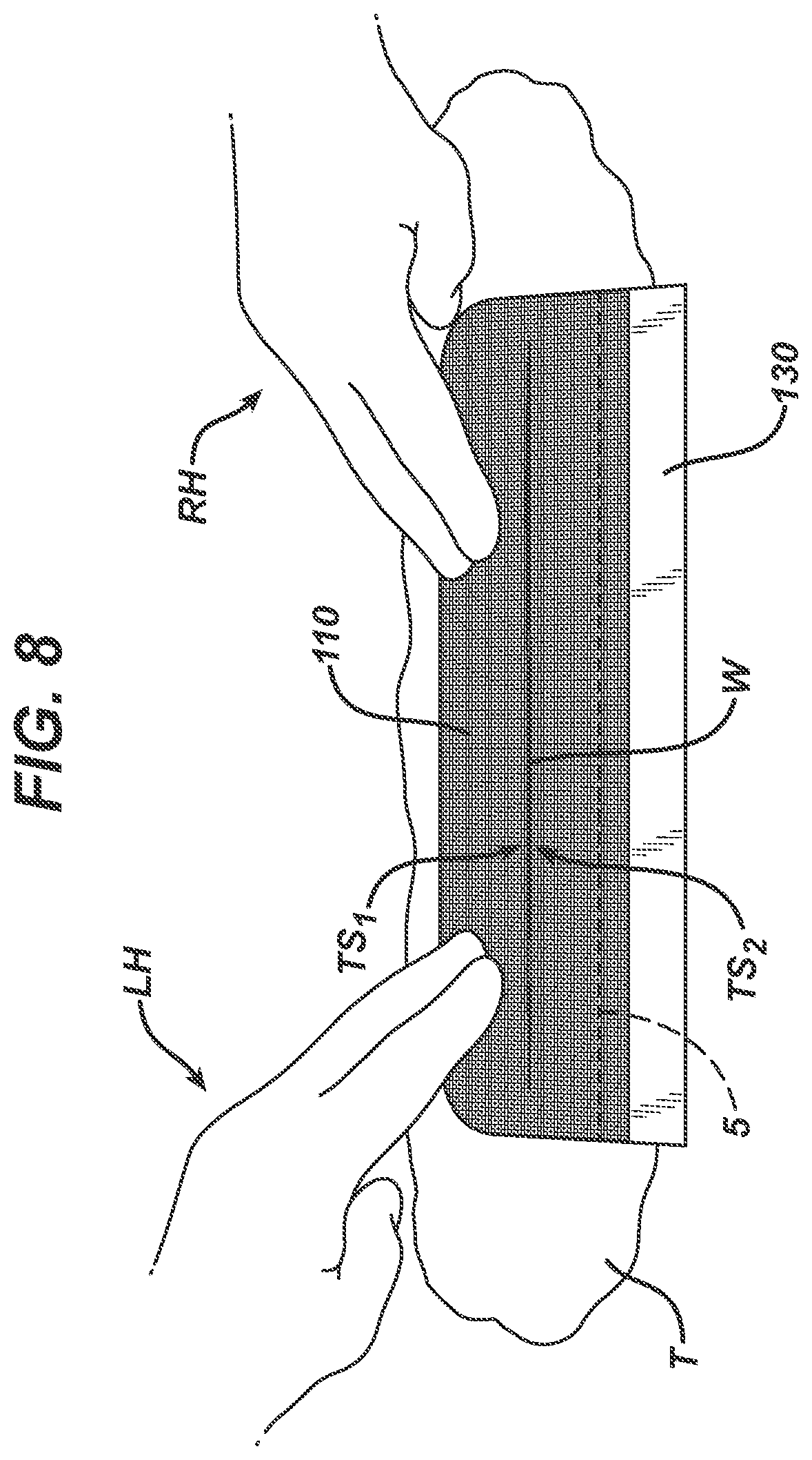 Patent US12403043 Figure 4 – Methods and devices for skin closure