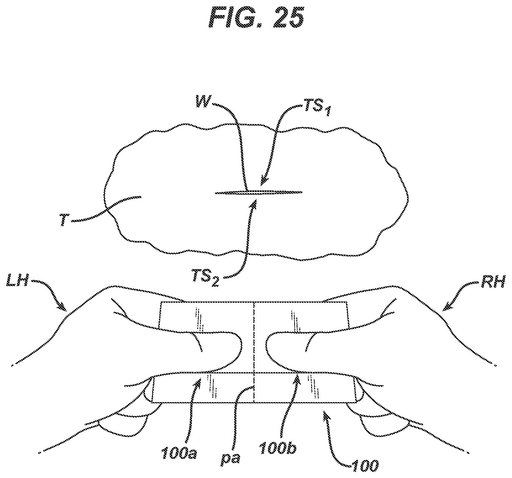 Patent US12403043 Figure 13 – Methods and devices for skin closure