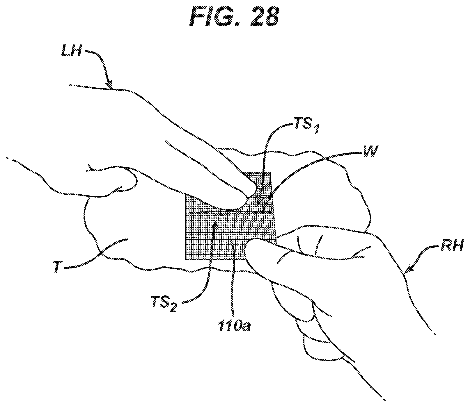 Patent US12403043 Figure 16 – Methods and devices for skin closure