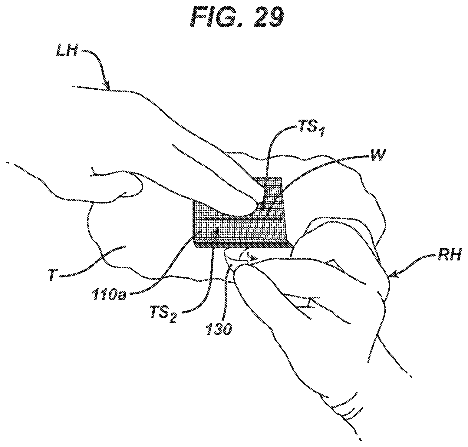 Patent US12403043 Figure 17 – Methods and devices for skin closure