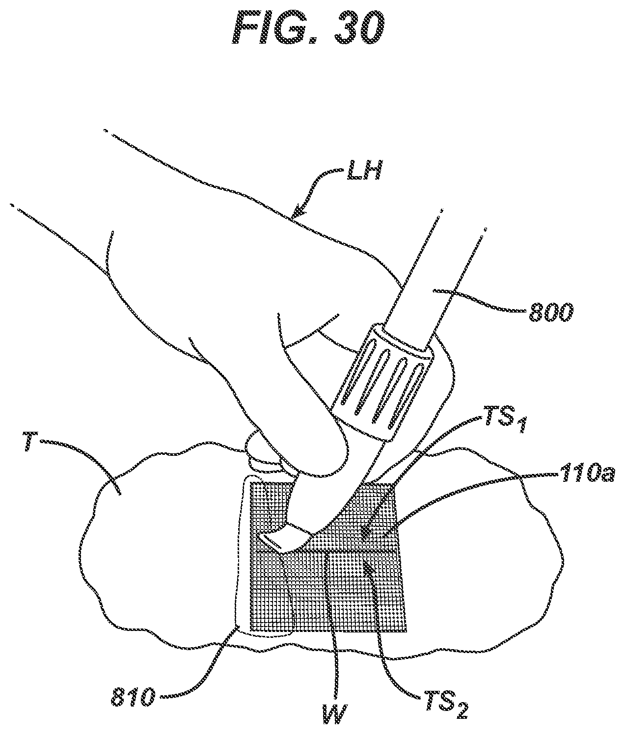 Patent US12403043 Figure 18 – Methods and devices for skin closure