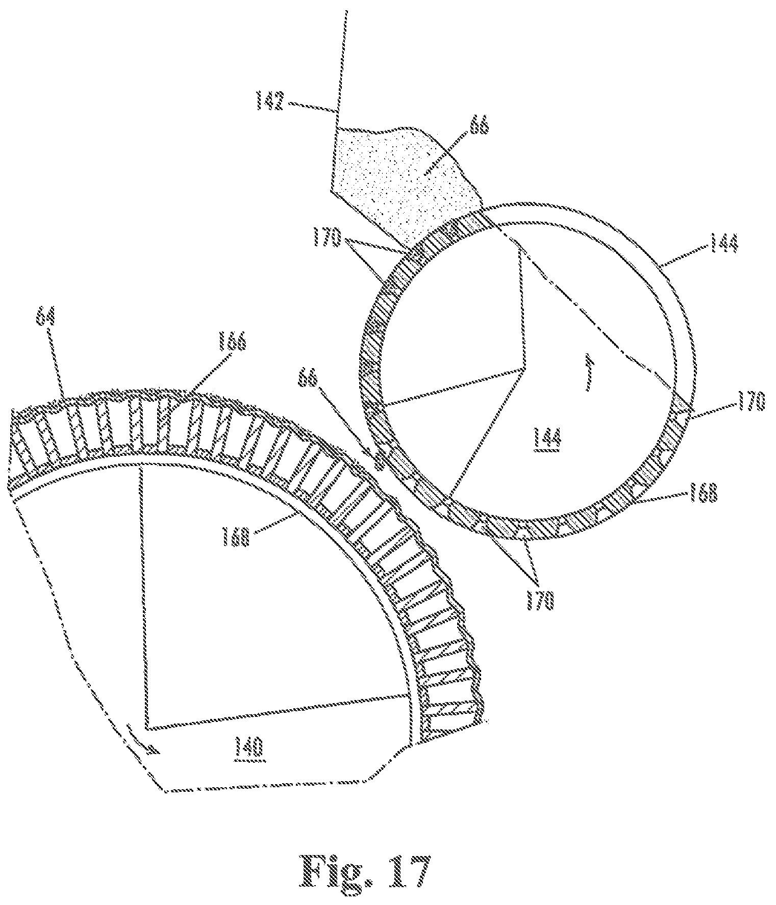 Patent US12403048 Figure 16 – Disposable absorbent article