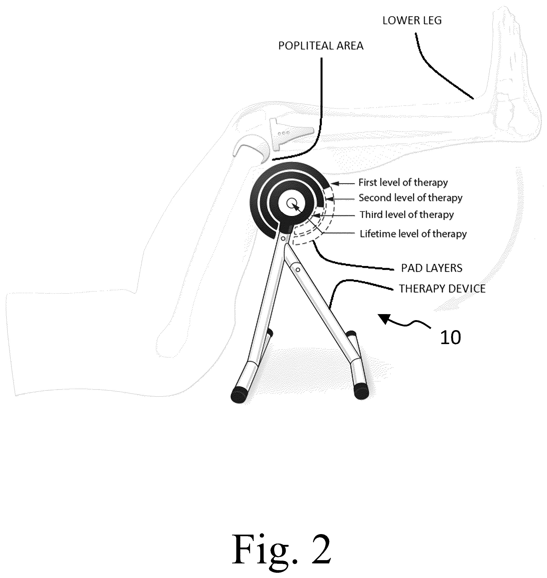 Patent US12403059 Figure 2 – Systems and methods for knee joint therapy