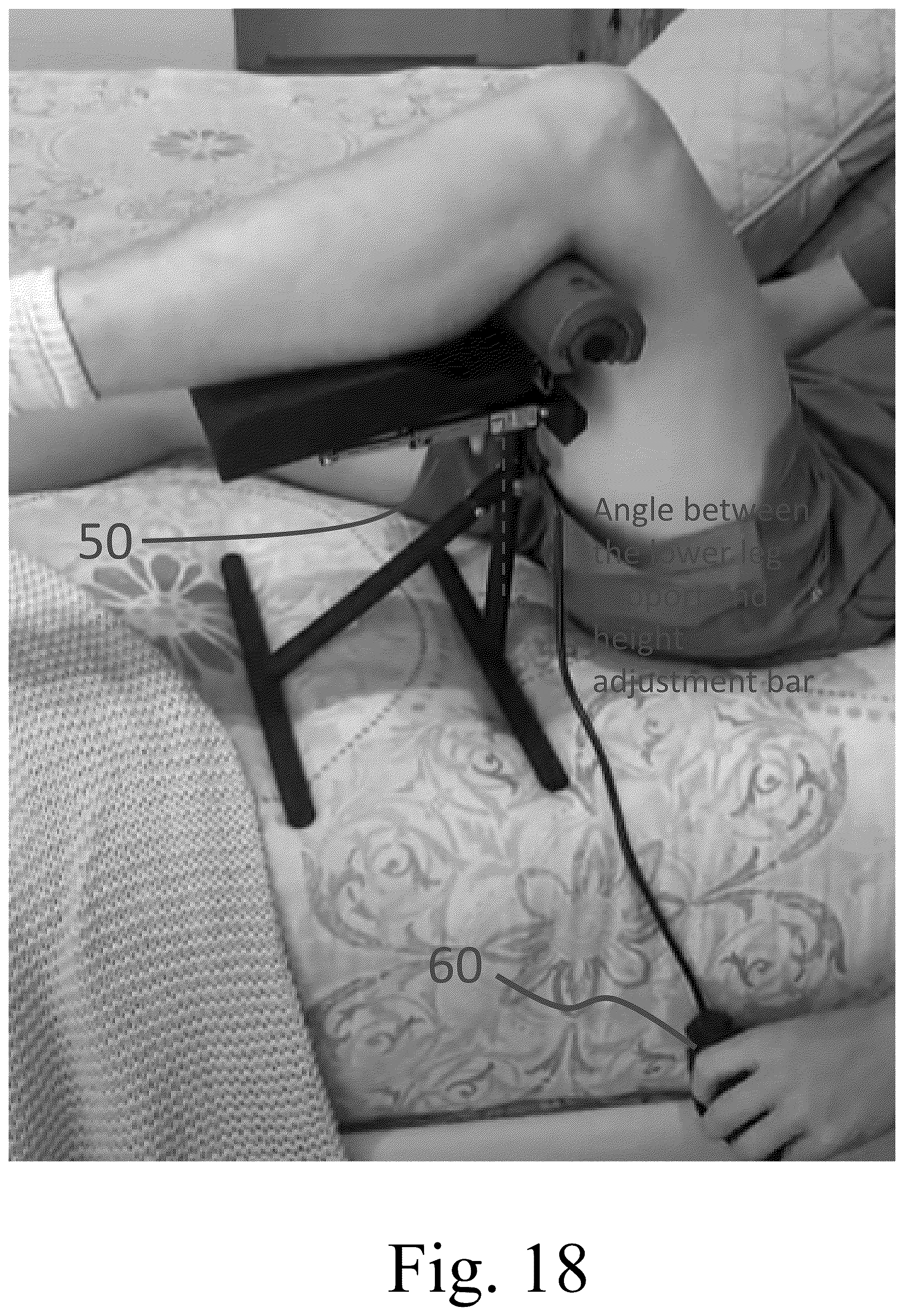 Patent US12403059 Figure 16 – Systems and methods for knee joint therapy