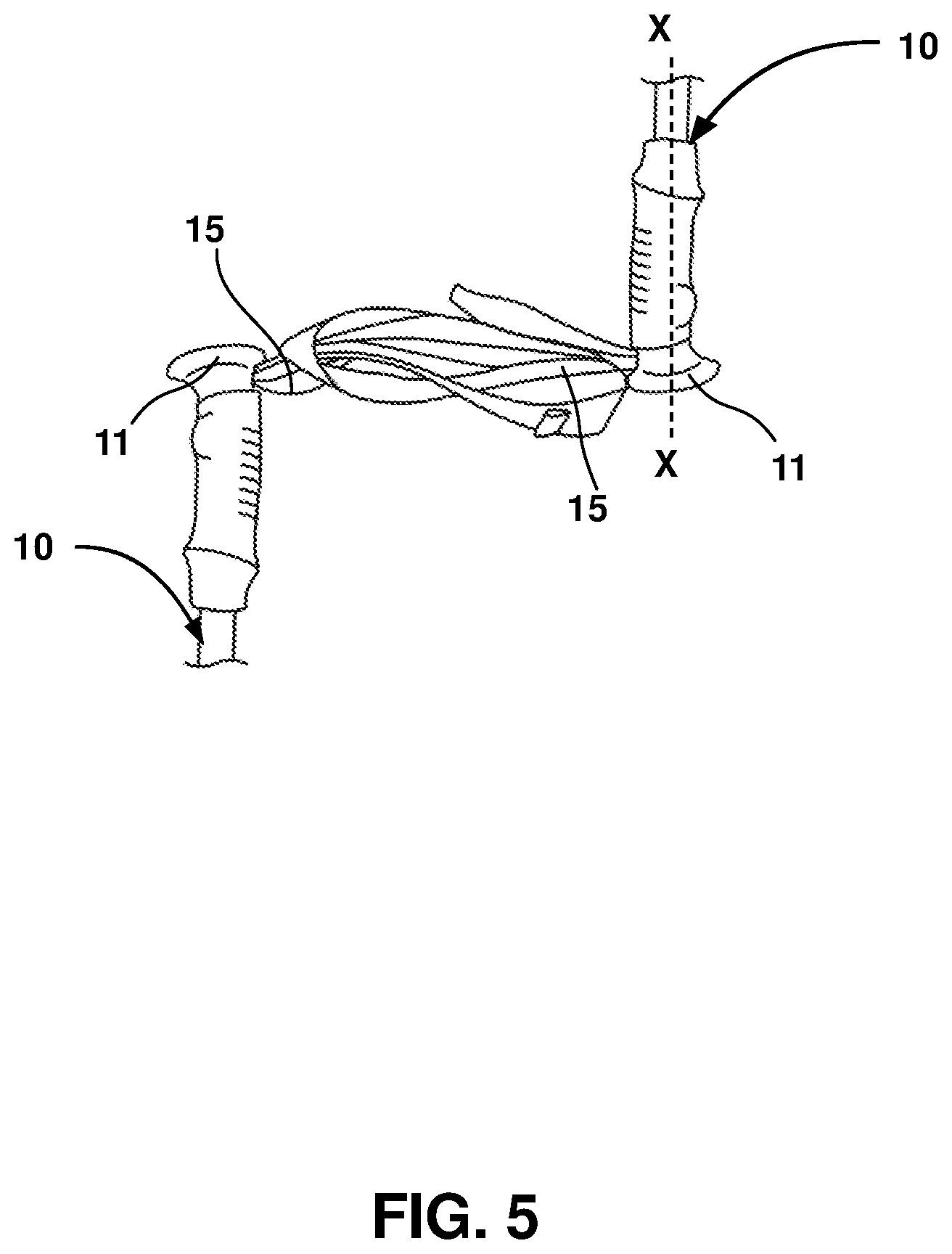 Patent US12403062 Figure 5 – Crutch assembly constructed using a pair of hiking poles