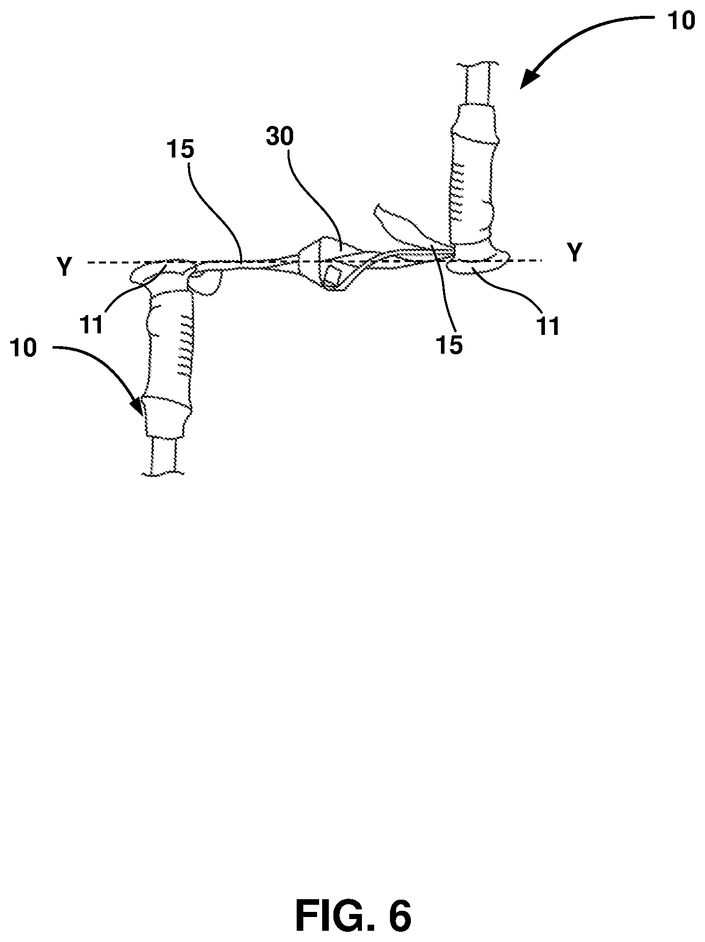 Patent US12403062 Figure 6 – Crutch assembly constructed using a pair of hiking poles