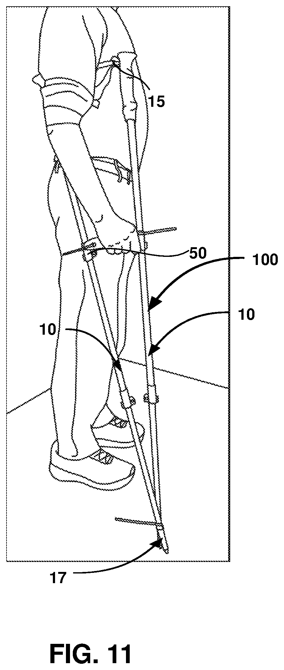 Patent US12403062 Figure 11 – Crutch assembly constructed using a pair of hiking poles