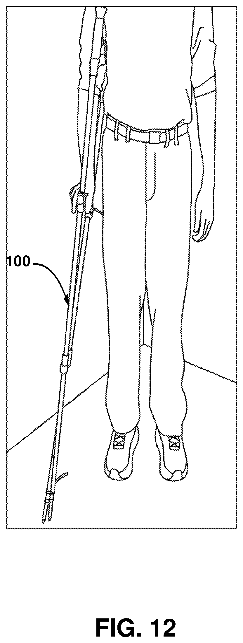 Patent US12403062 Figure 12 – Crutch assembly constructed using a pair of hiking poles