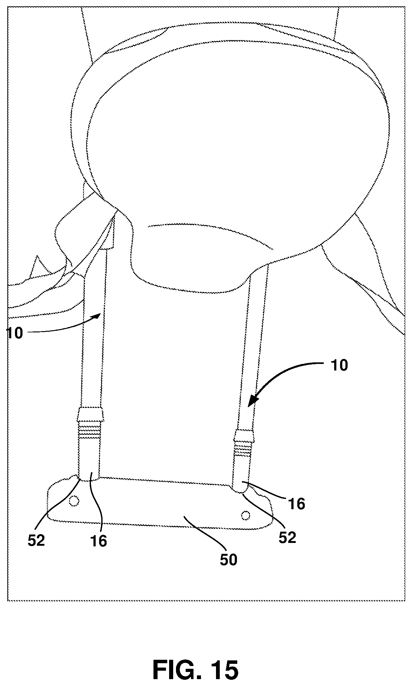 Patent US12403062 Figure 15 – Crutch assembly constructed using a pair of hiking poles