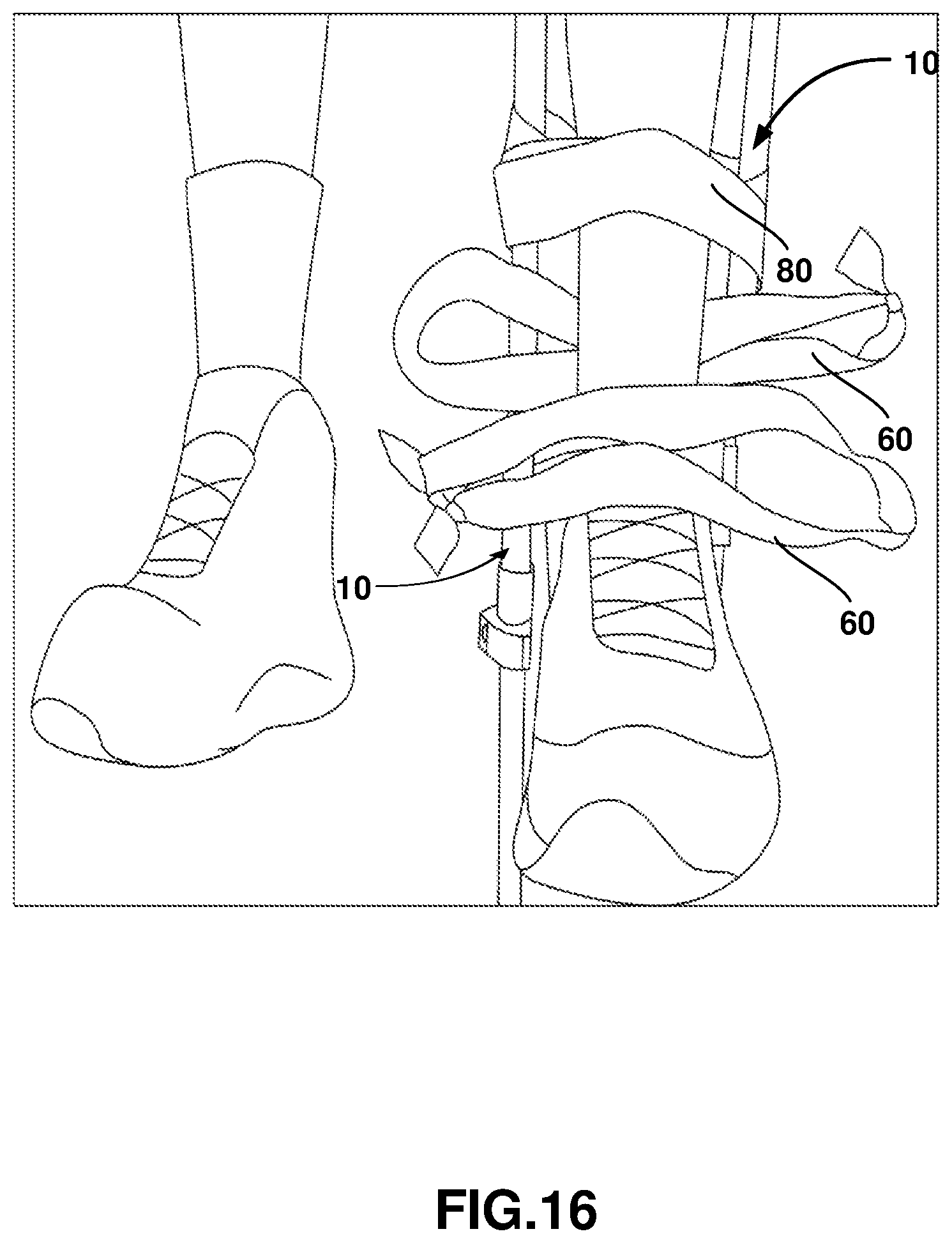 Patent US12403062 Figure 16 – Crutch assembly constructed using a pair of hiking poles