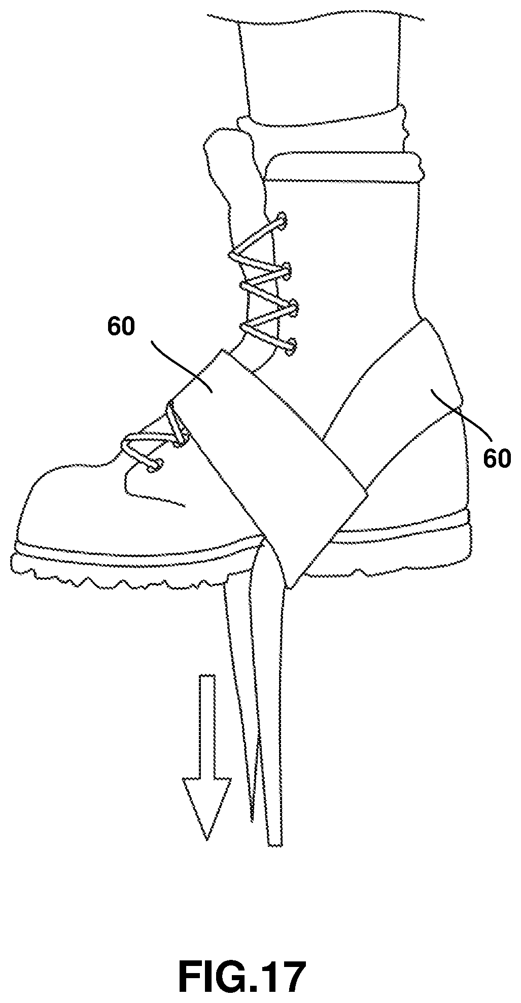 Patent US12403062 Figure 17 – Crutch assembly constructed using a pair of hiking poles