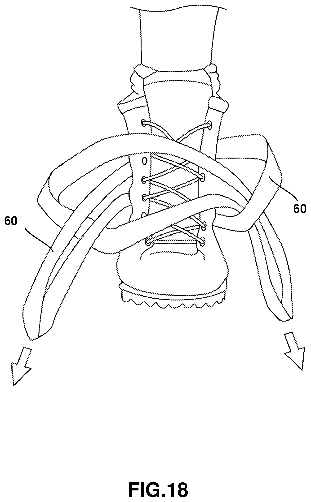Patent US12403062 Figure 18 – Crutch assembly constructed using a pair of hiking poles