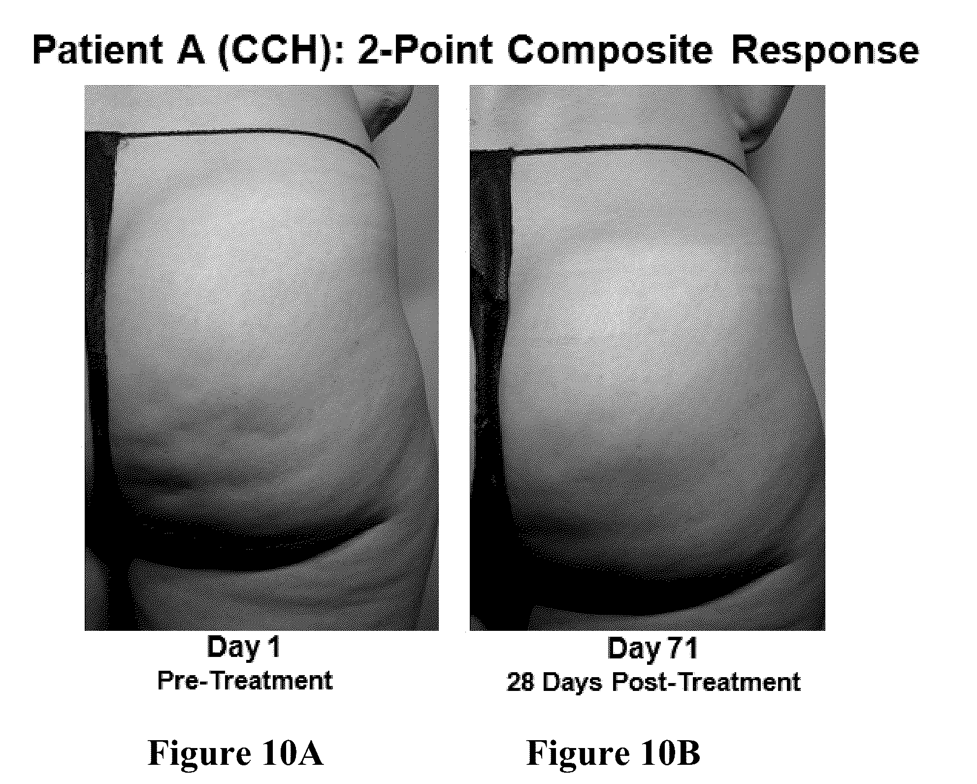 Patent US12403081 Figure 9 – Method of assessing and treating cellulite