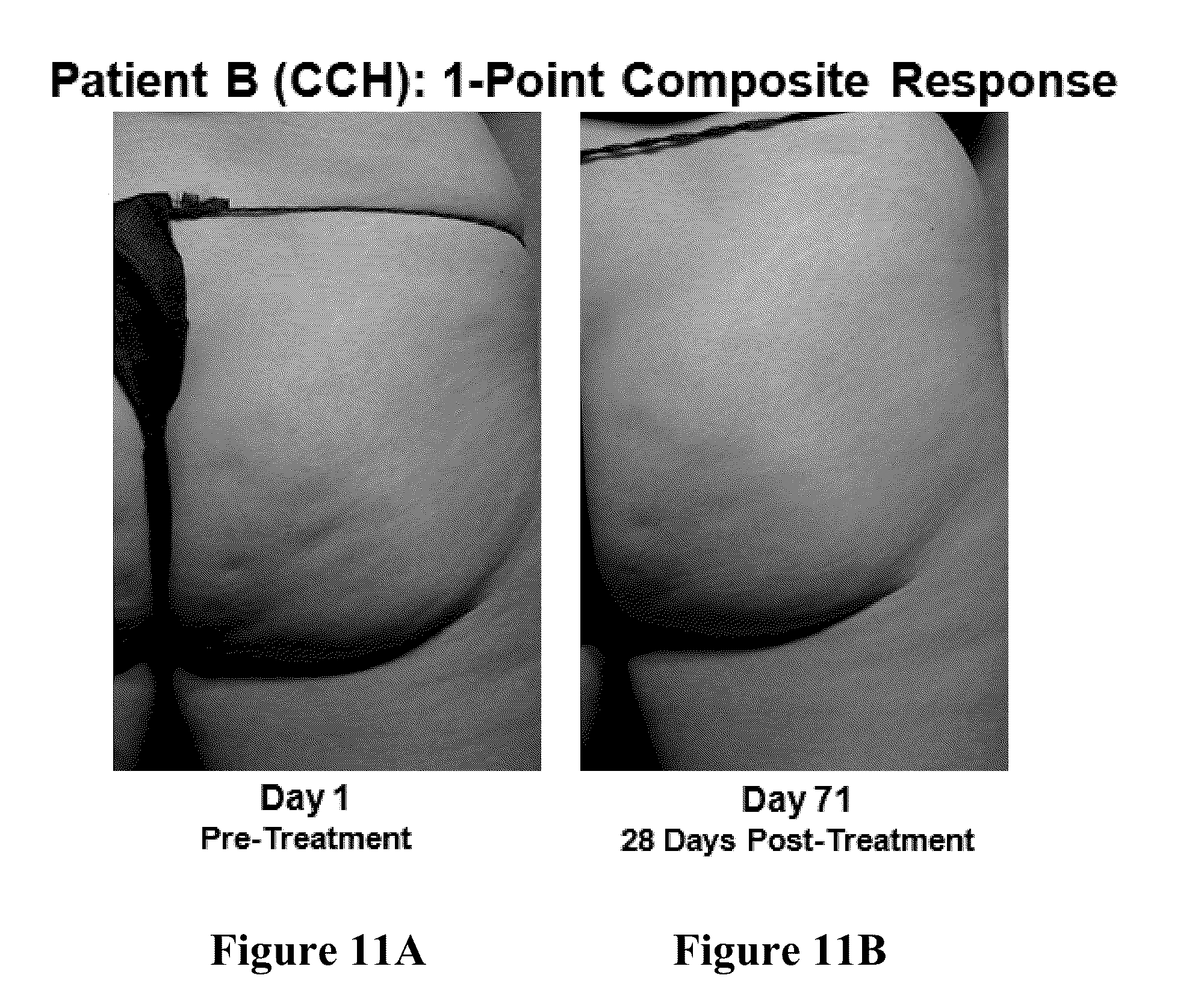 Patent US12403081 Figure 10 – Method of assessing and treating cellulite