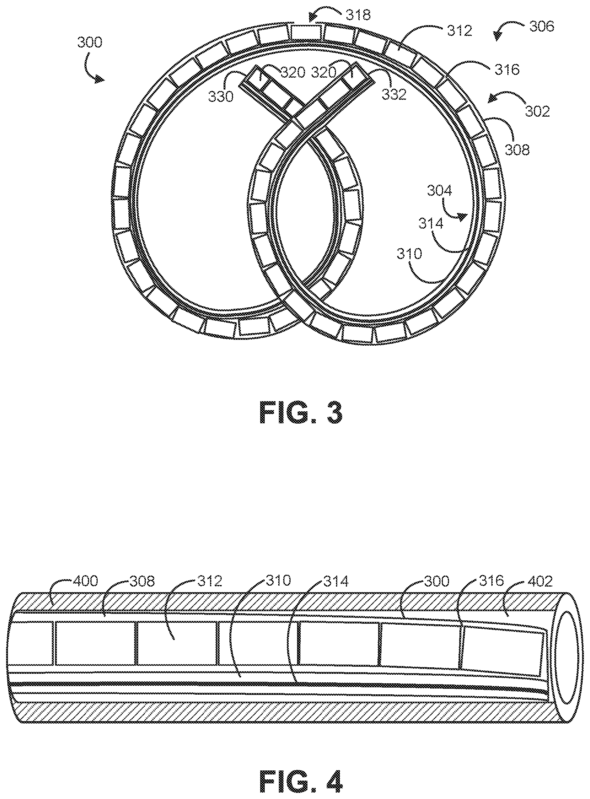 Patent US12403086 Figure 2 – Solid drug tablets for implantable drug delivery devices